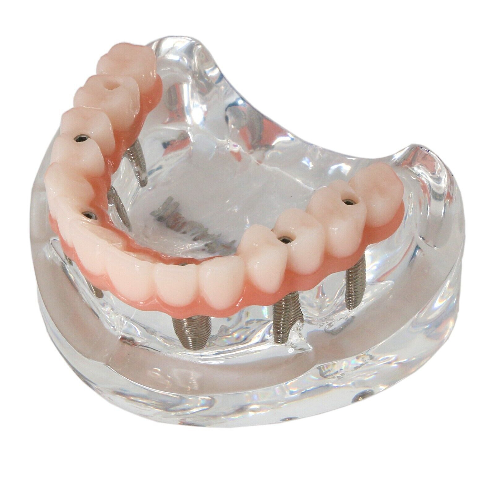 US Dental Implant Restoration Model Upper Jaw 6 Screws Post Core Bridge M6001-2