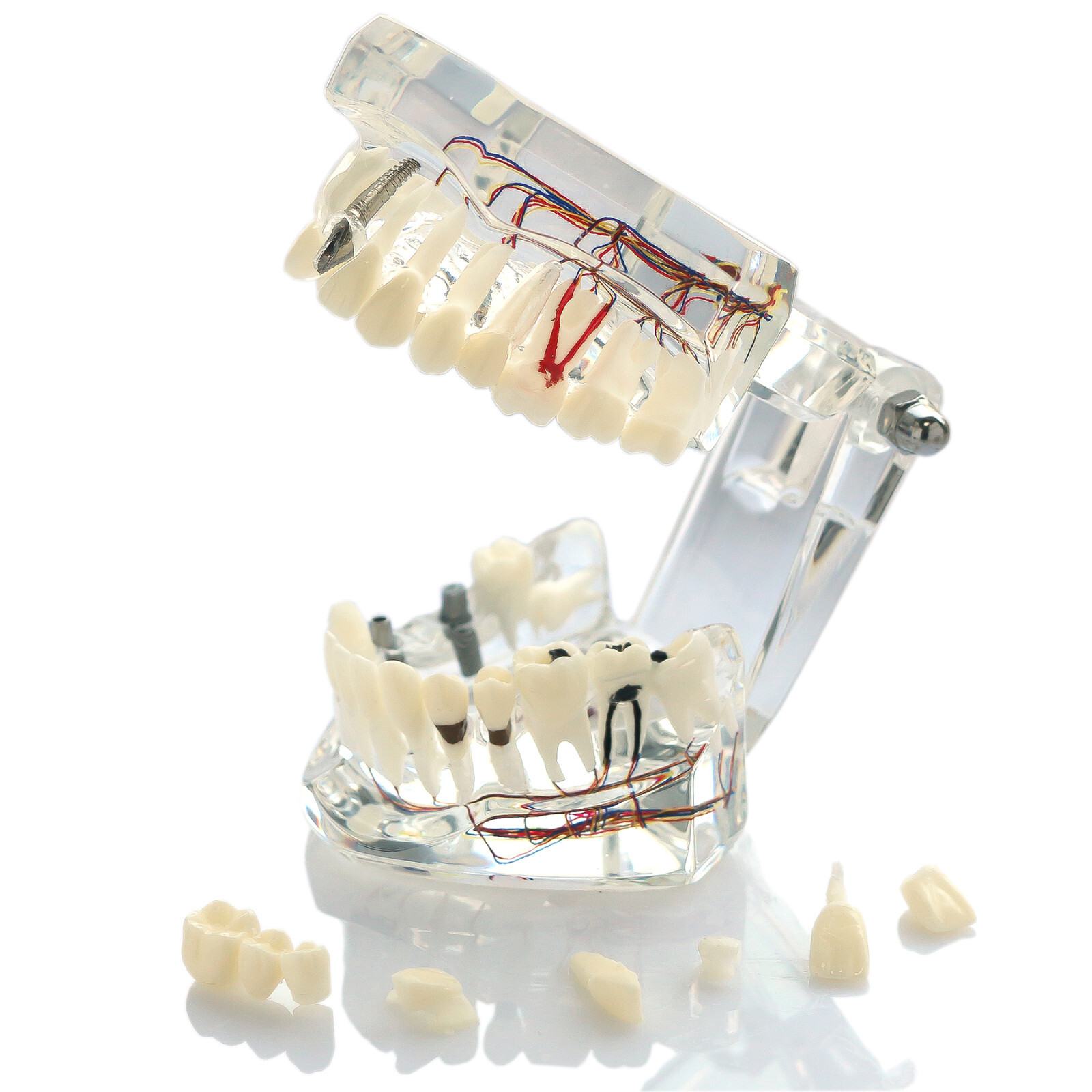 Dental Oral Typodont Model Implant Pathological Removable Teach Visible Anatomy