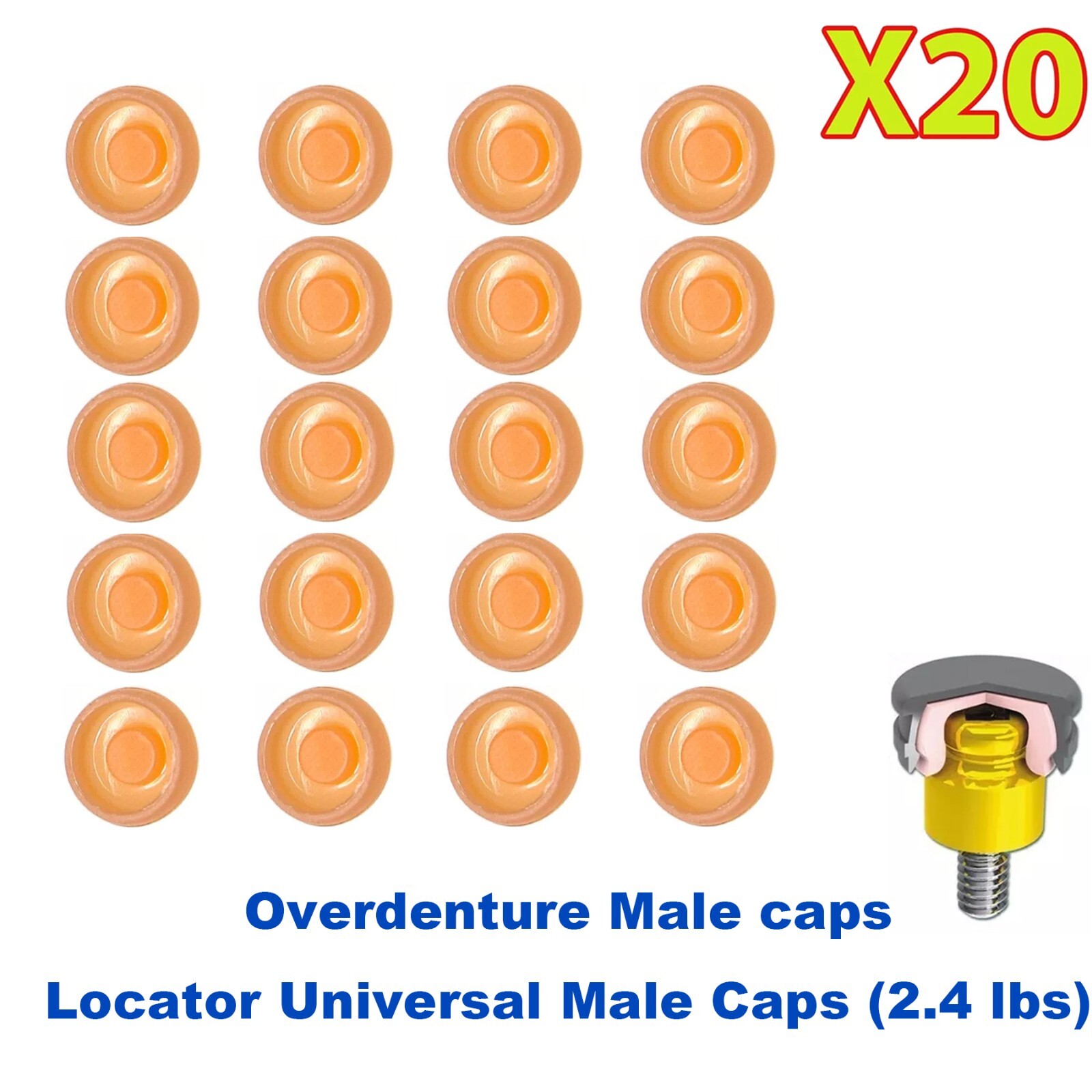 US 20Pcs Dental Overdenture Mini Retentive Caps 1.2/2.4lbs for Implants Locator