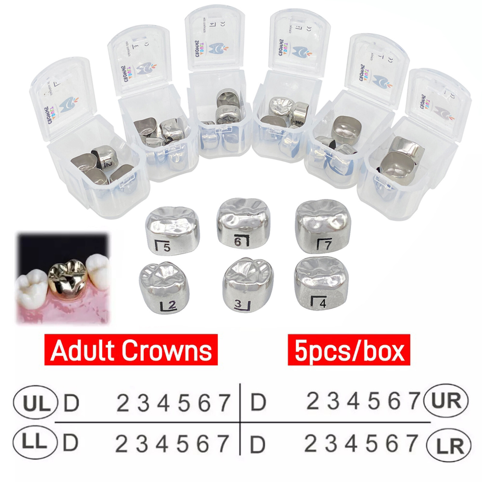 Dental Stainless Steel Adult Permanent Molar Teeth Crown All Sizes Kit & Refills