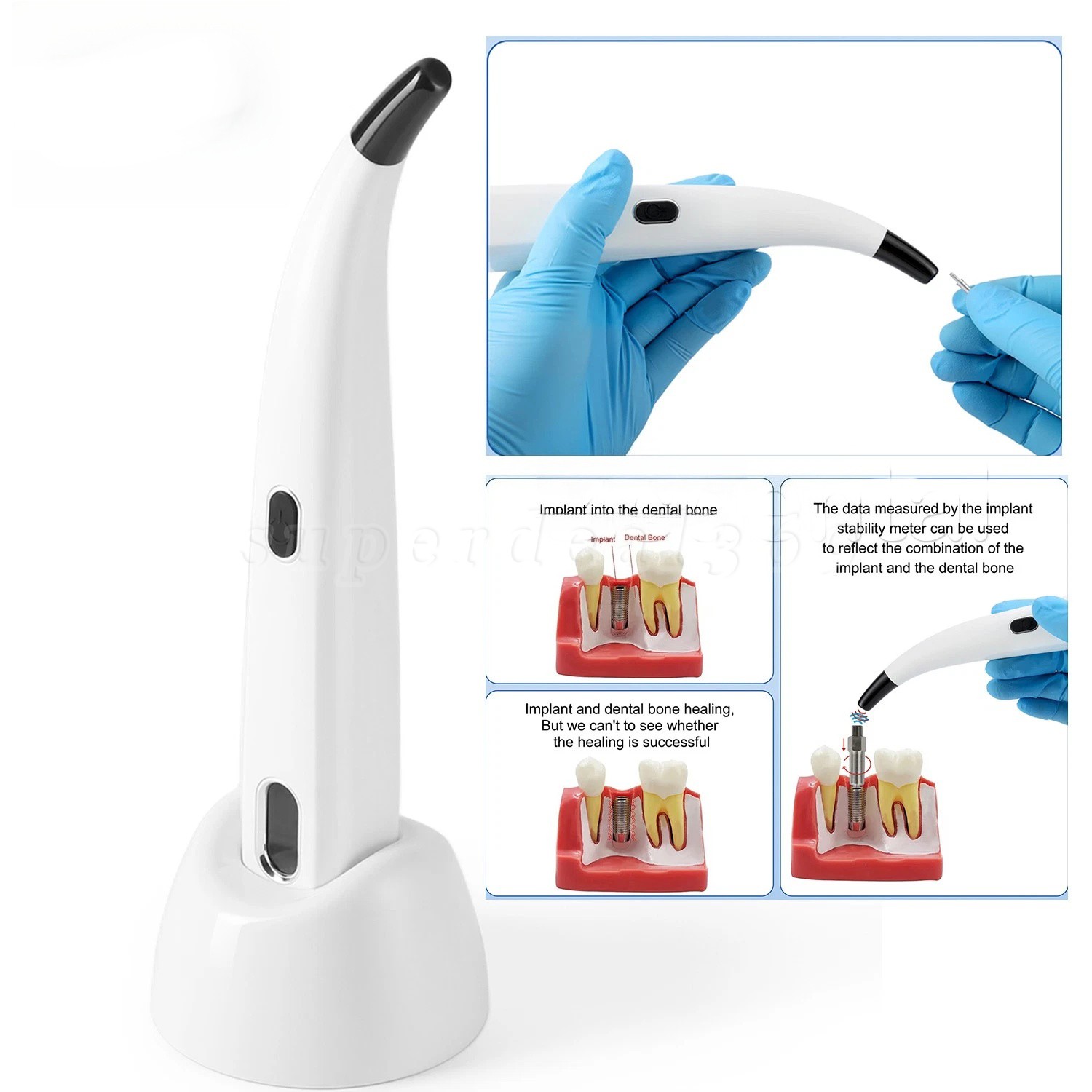 Dental ISQ Osseointegration Implant Stability Meter Measurement Tester Monitor