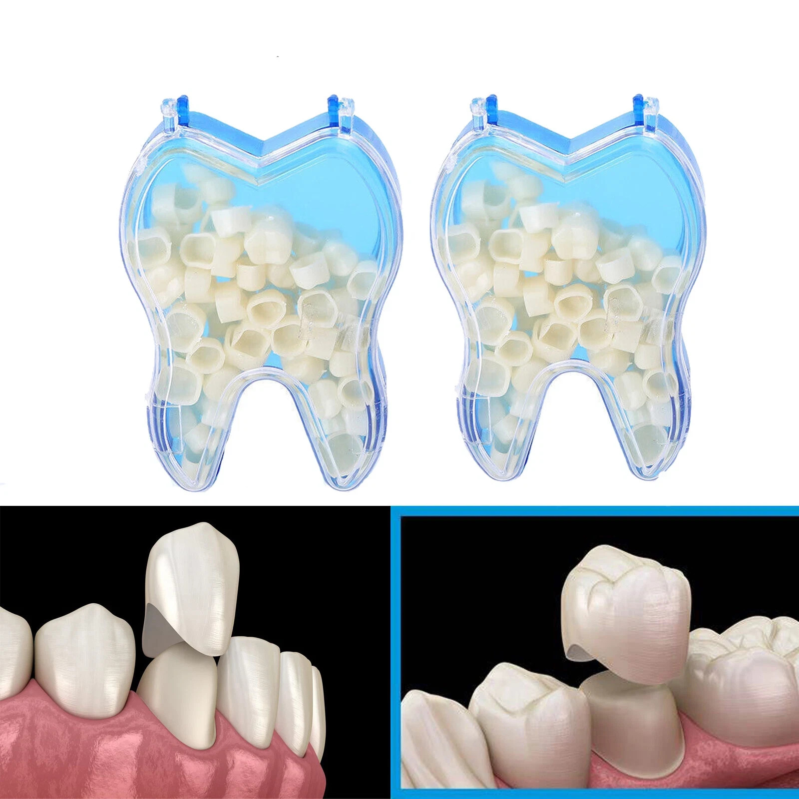 50 Pcs/Box Dental Whitening Front Temporary Crown Material Polycarbonate Tooth