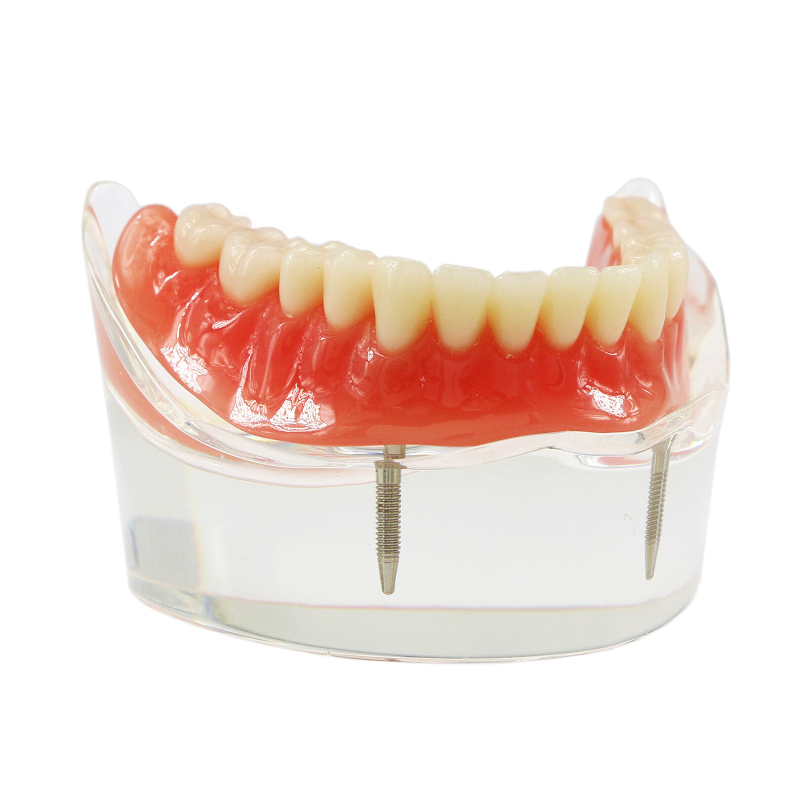 Multiple Types Dental Teeth Model Typodont Ortho Implant Practice Demo Teaching