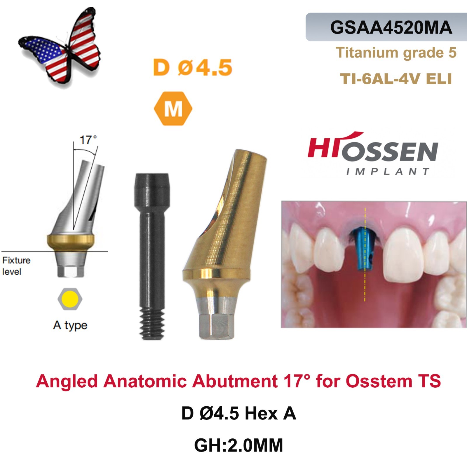 Titanium Straight & 17° Angled Transfer Abutment Compatible Osstem TS/Hiossen ET