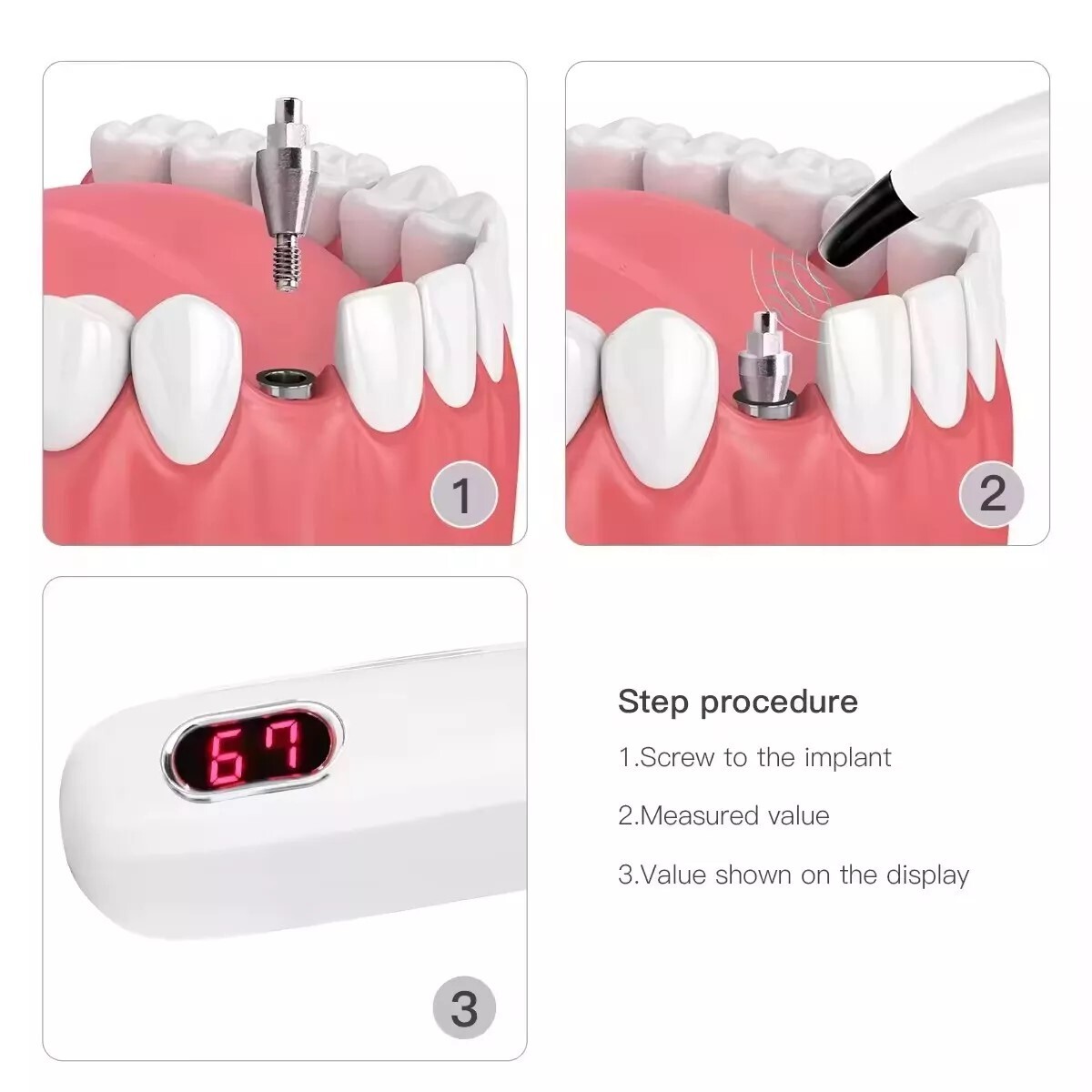Dental Monitor Osseointegration RFA Inplant Stability Measurement Test Unit ISQ