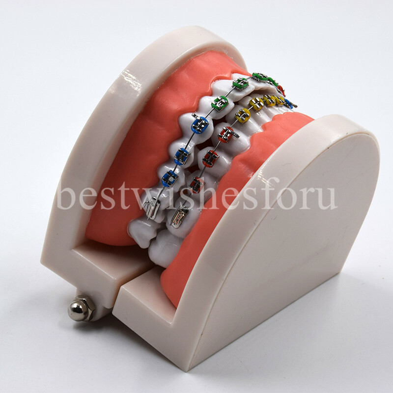 1*Dental Orthodontic Standard Teeth Tooth Model Metal Brackets & Ligature Ties