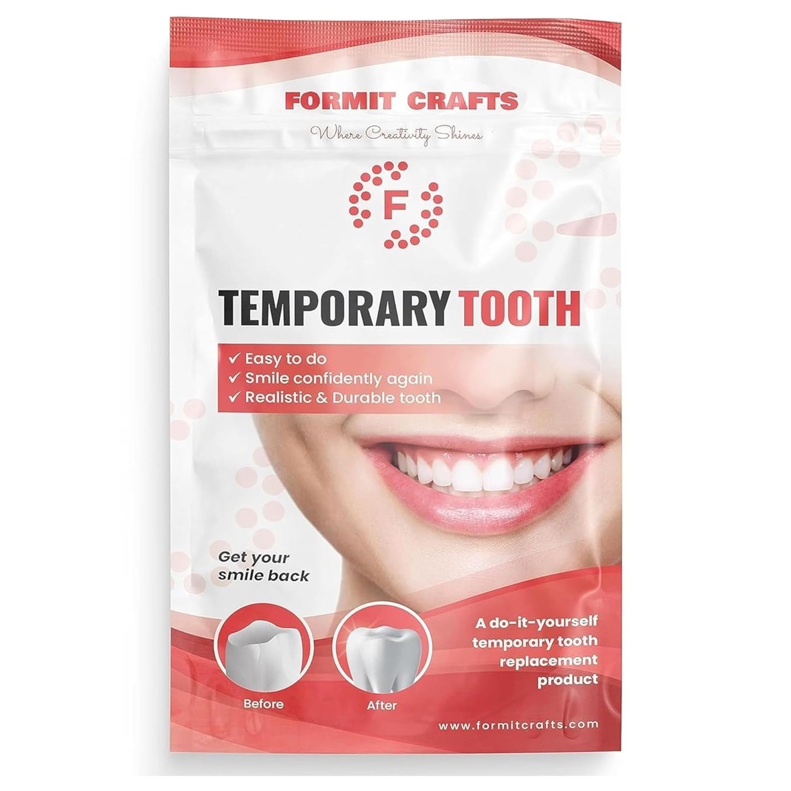 Thermoplastic Beads for Teeth Repair– DIY Tooth Filling – 60 Gram