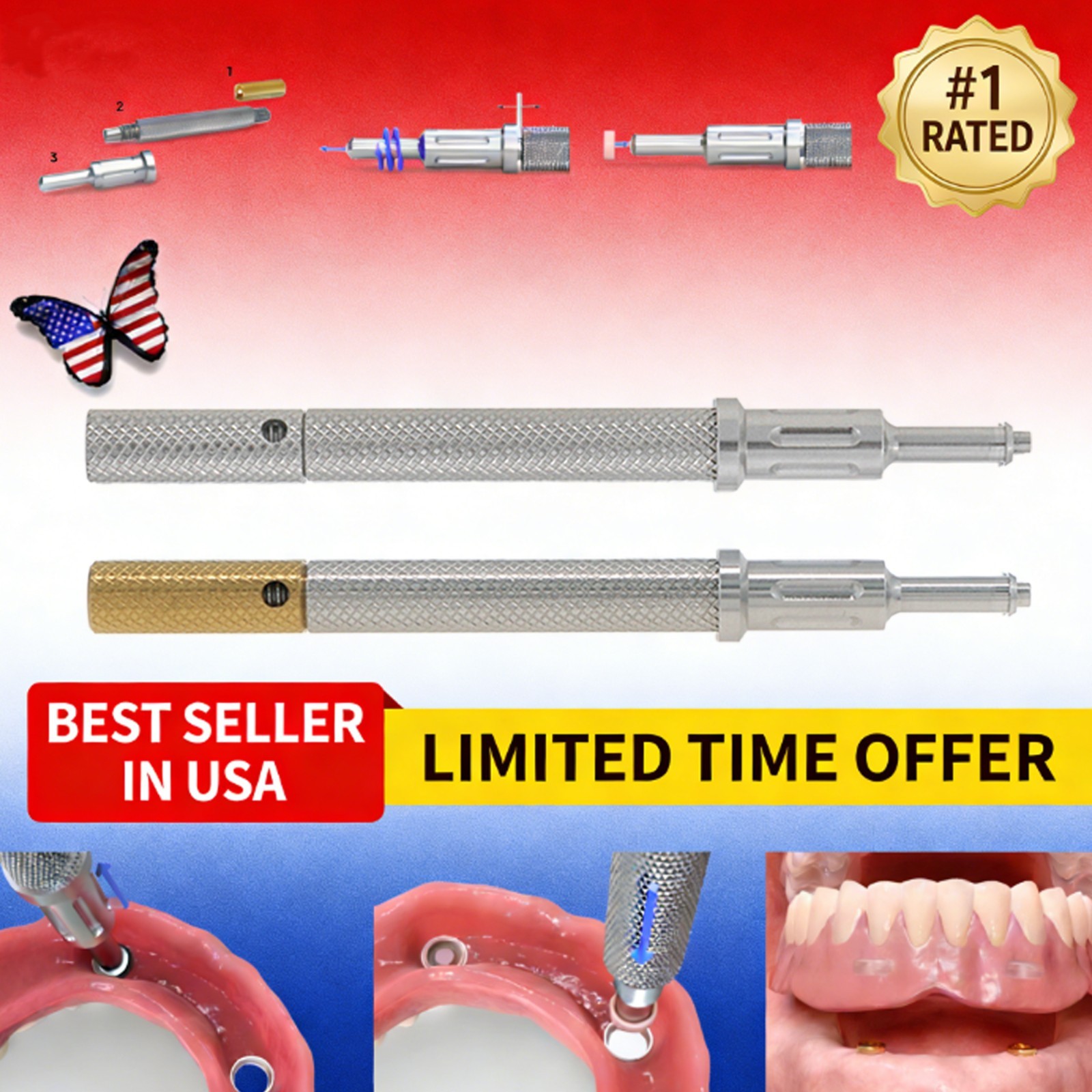 US Dental Novaloc & Locator Core Tool Mounting & Demounting Instrument Retention