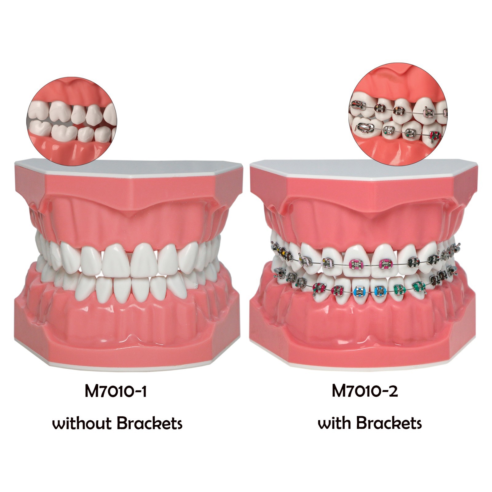 Dental Typodont Orthodontic Teeth Model with Brackets Brushing Flossing Practice