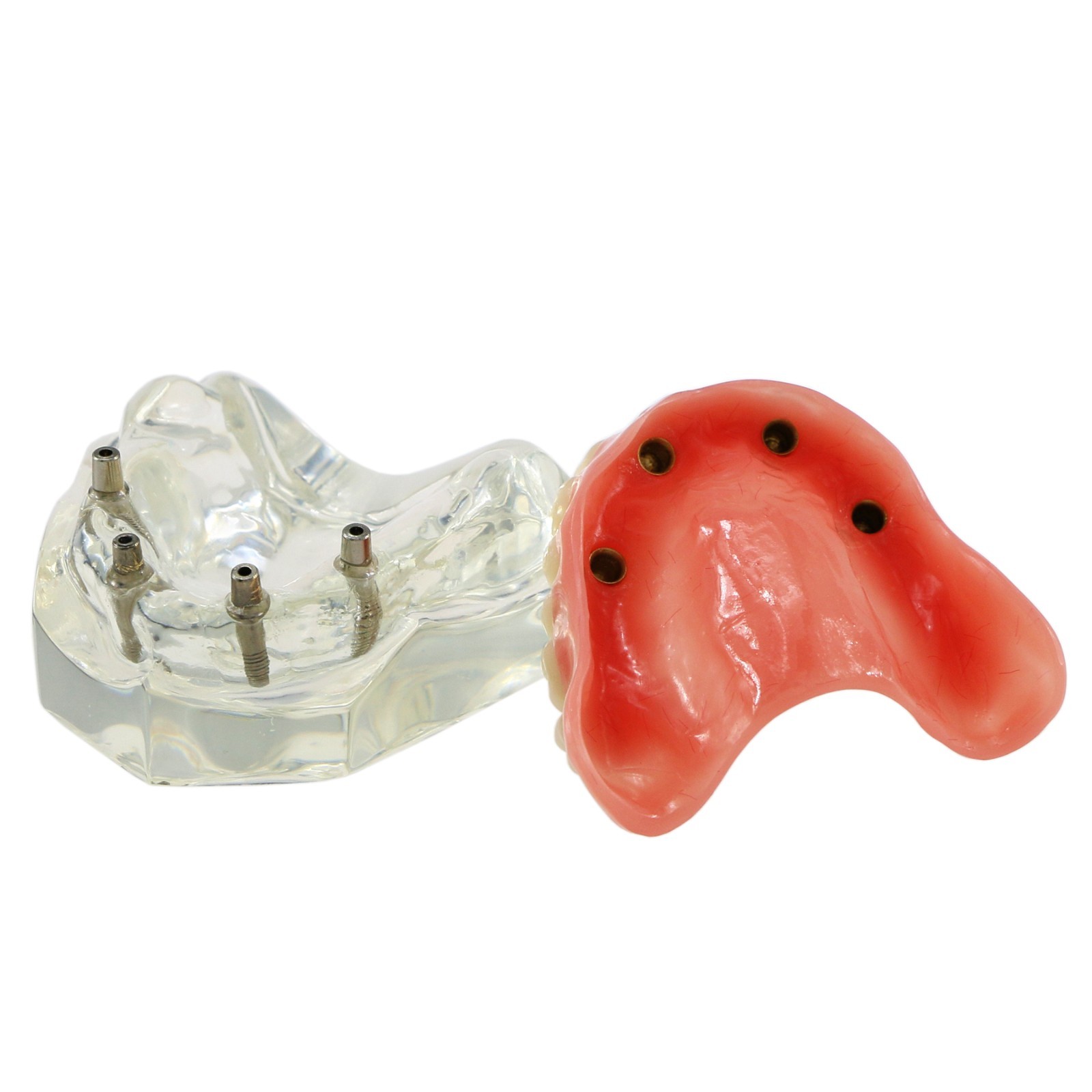 Dental Implant Overdenture Model Upper Lower Jaw Teeth Model with 2/4/6 Screws