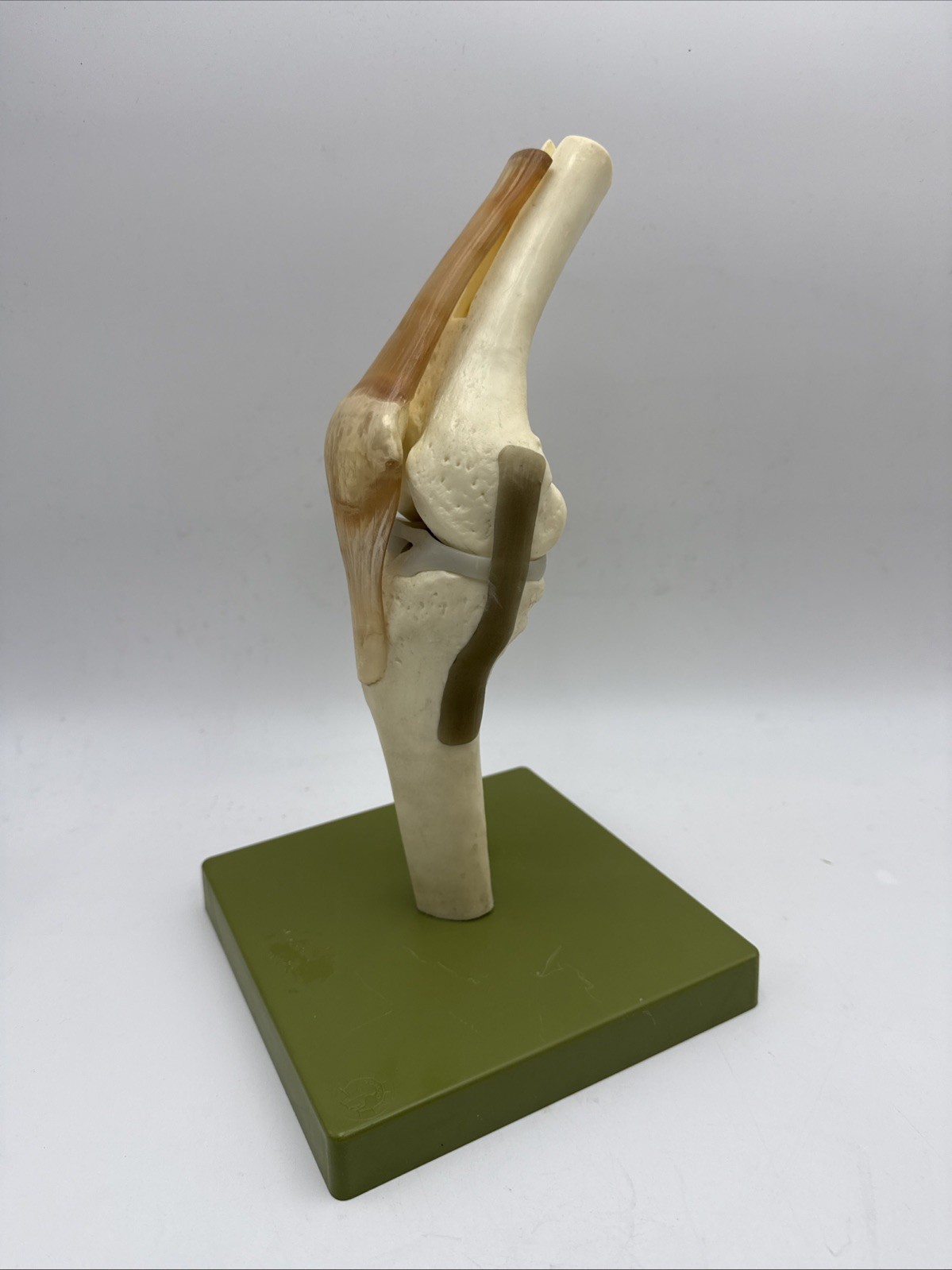 Somso NS50 Functional Knee Joint with Ligaments Anatomical Model NS 50