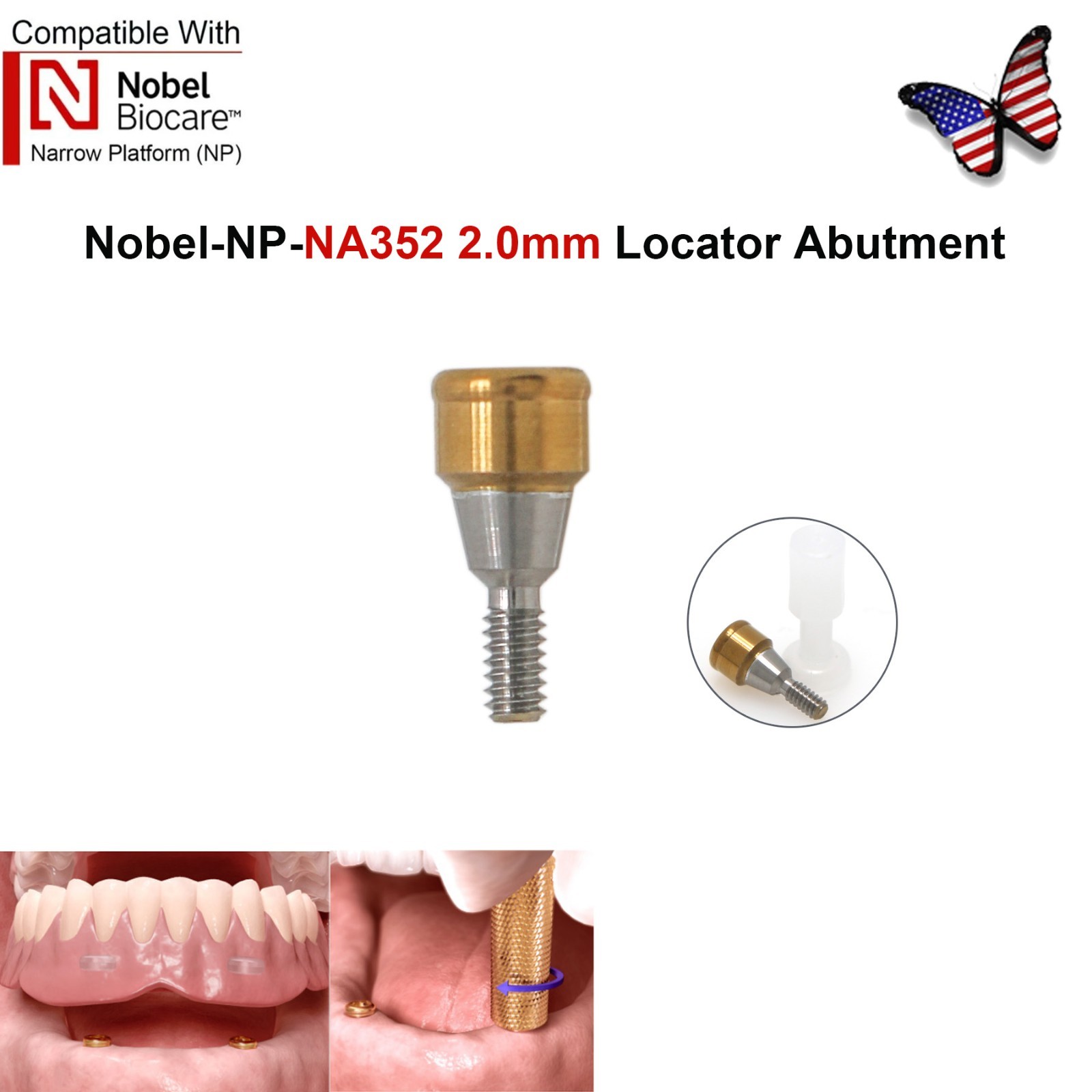 Dental Locator Abutment NP RP Compatible with Nobel NBL Active Implant AH 1–5mm