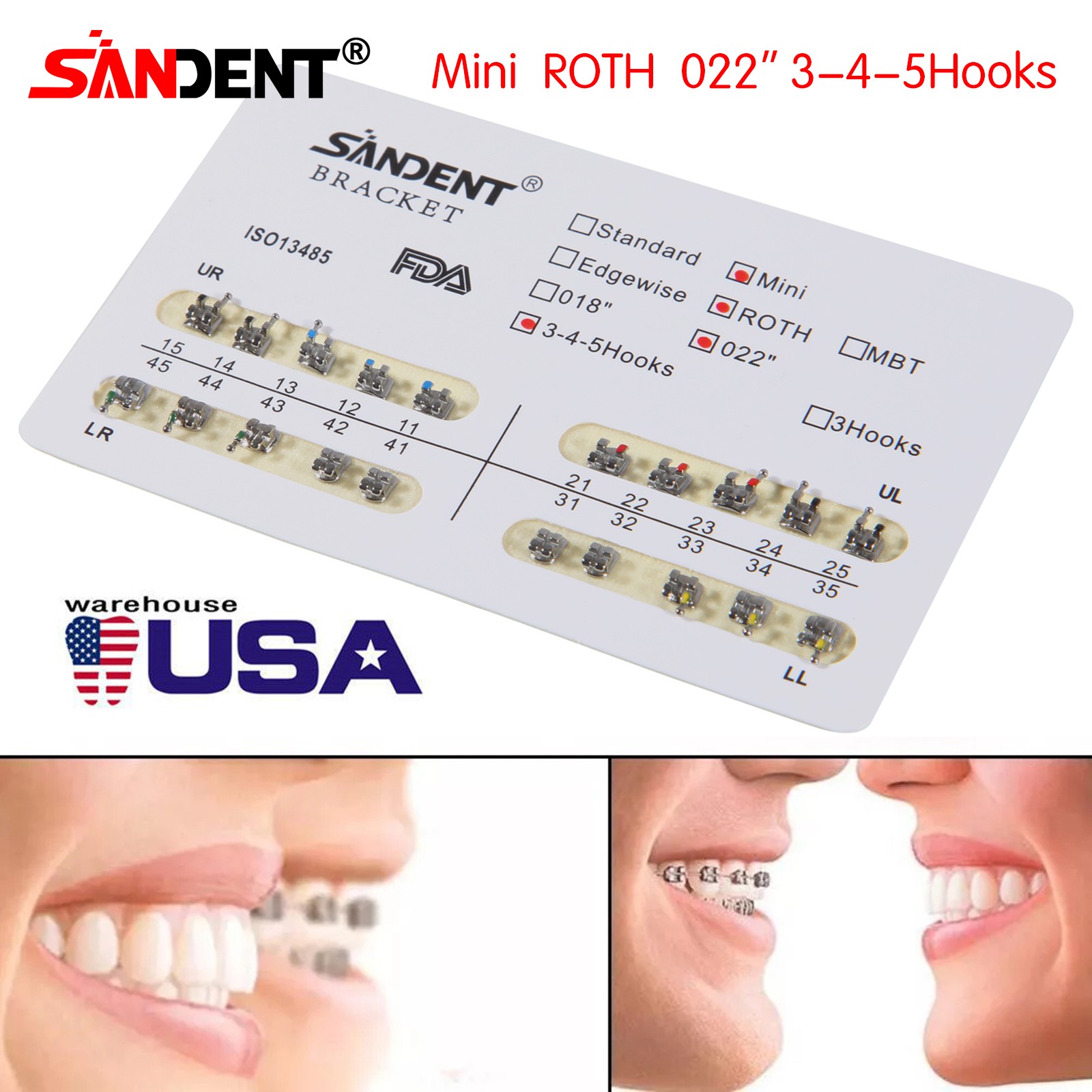 5X Puntas de escalador ultrasónico dental P1 Fit EMS Cavitron pieza de mano USA