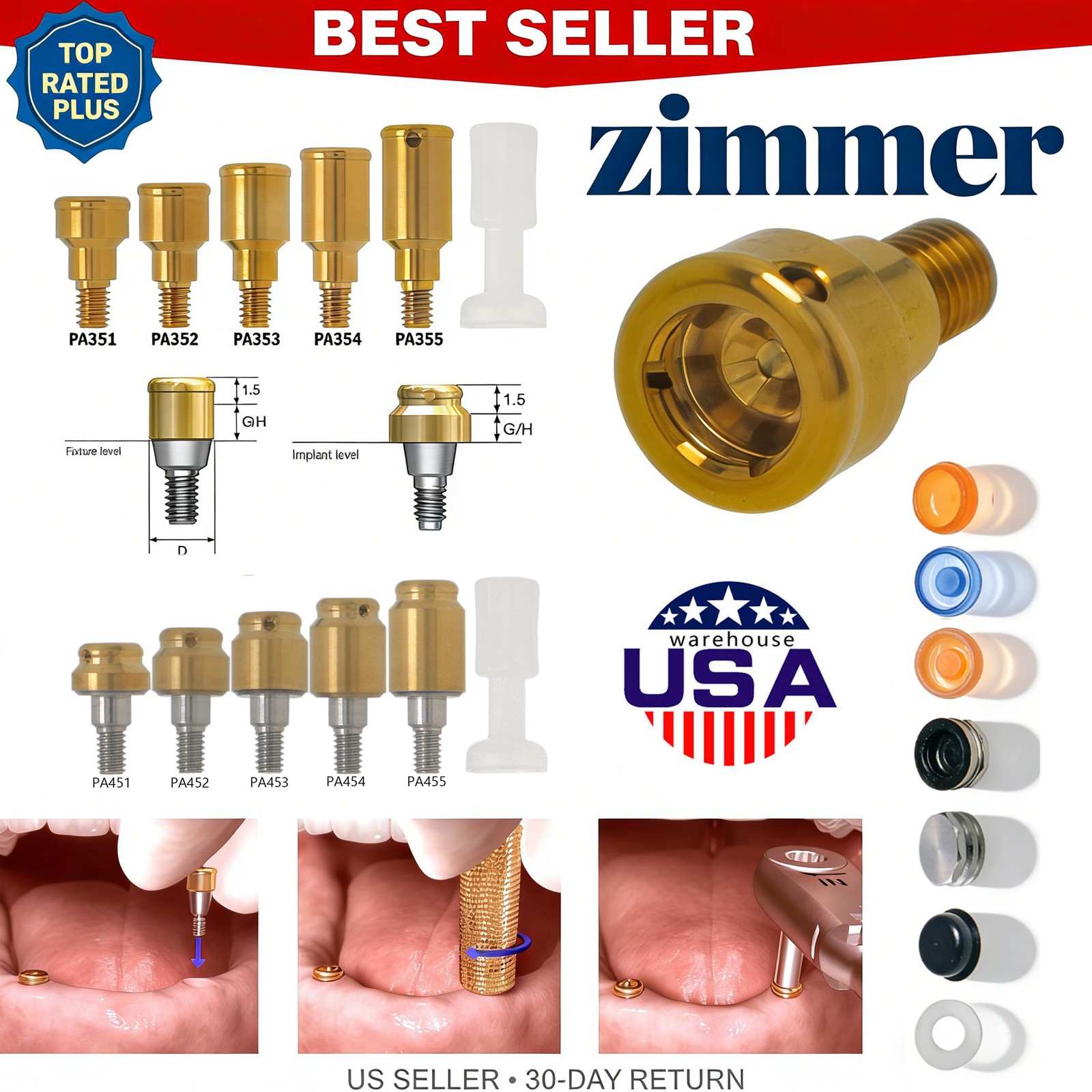 Dental Overdenture Zest Locator Abutment Legacy Anchor Hiossen Nobel Zimmer Cap