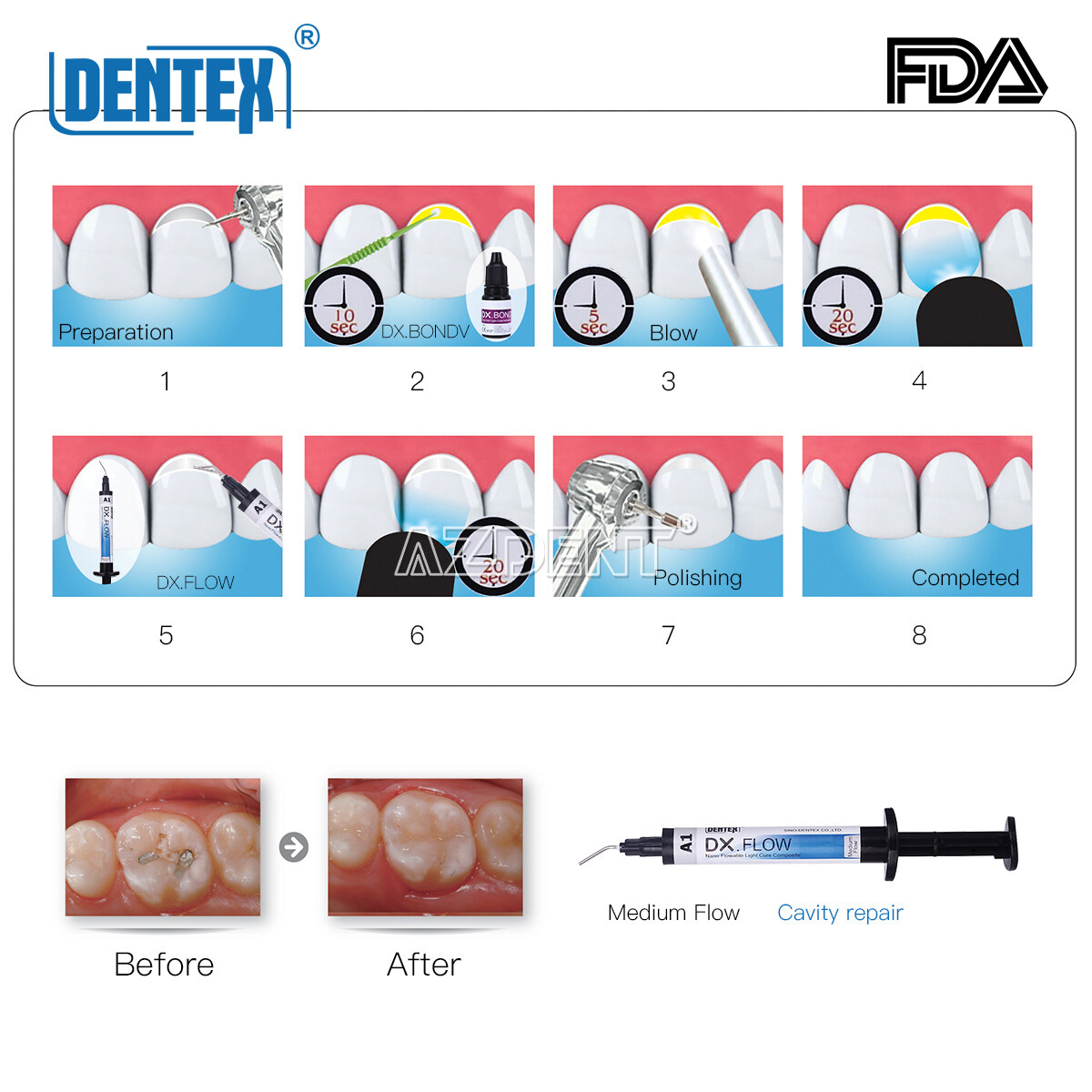 DENTEX Dental Flowable Light Cure Composite Resin Medium Flow A1/A2/A3 Shade