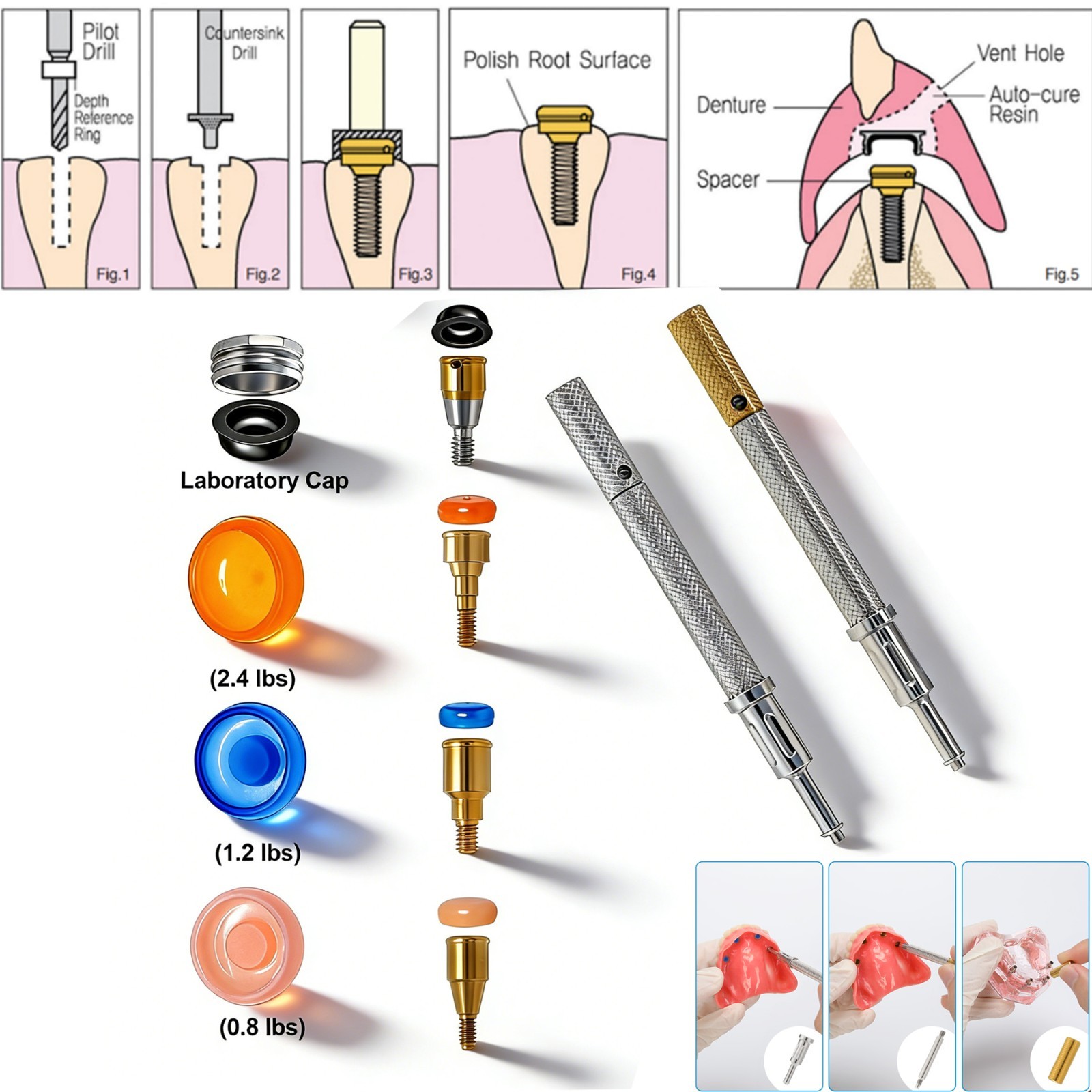 US Dental Fit Zest Anchors Locator Retention Caps Range & Core Tool Overdenture