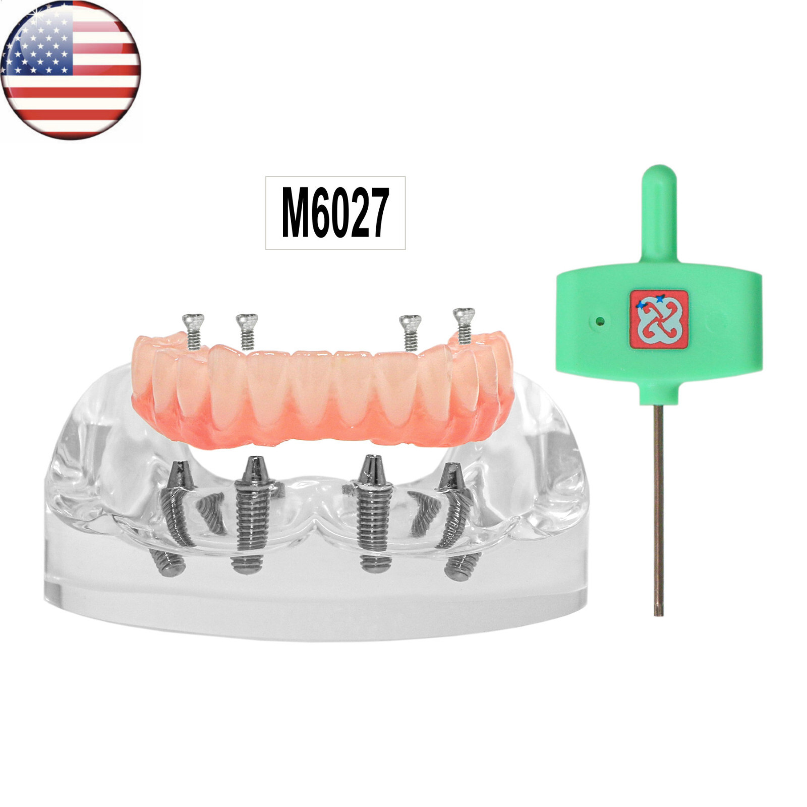 US Dental Overdenture All-on-4 Model Upper/Lower Jaw-Clear Implant With 4 Screws