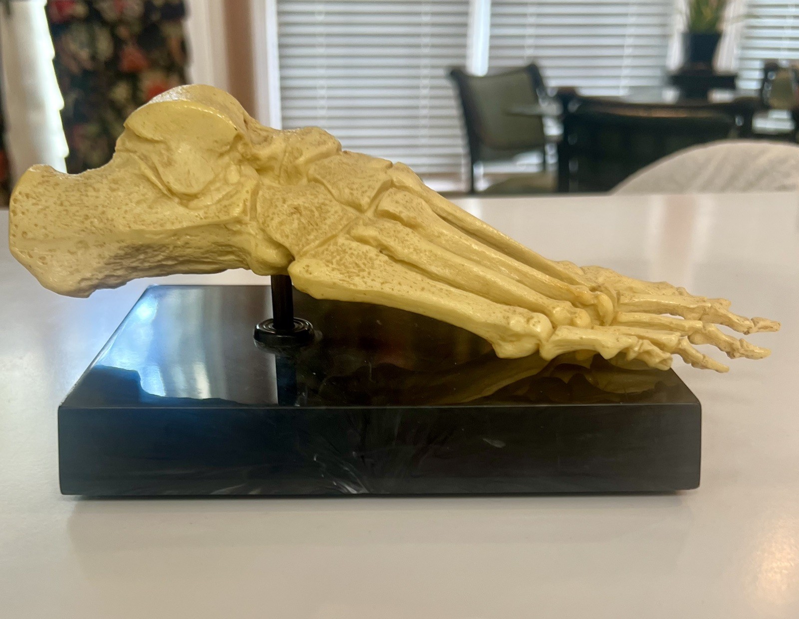 Anatomic and Pathological Foot Skeletal Models Foot Surgery, Podiatry, Orthopods