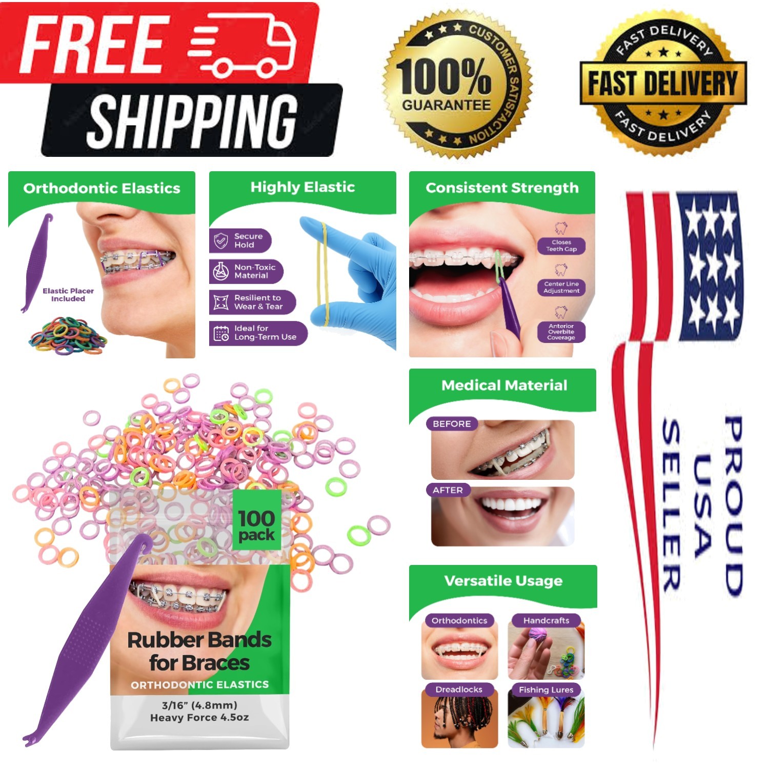 Versatile Neon 3/16″ Rubber Bands – 100 Pack for Braces & Craft Use With Placer