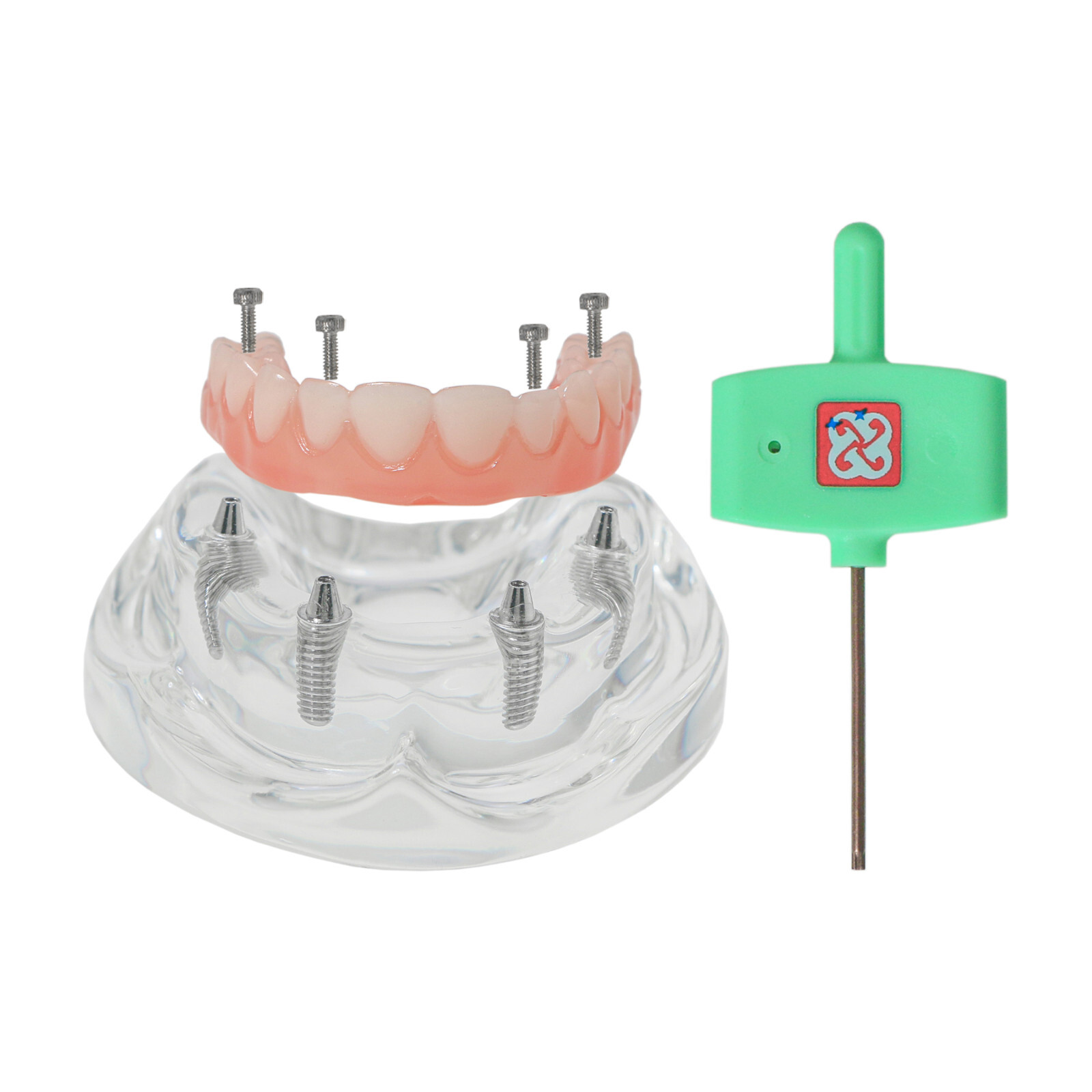 Dental 4 Implants Demo Implant Teeth Model Restoration Overdenture Upper/Lower