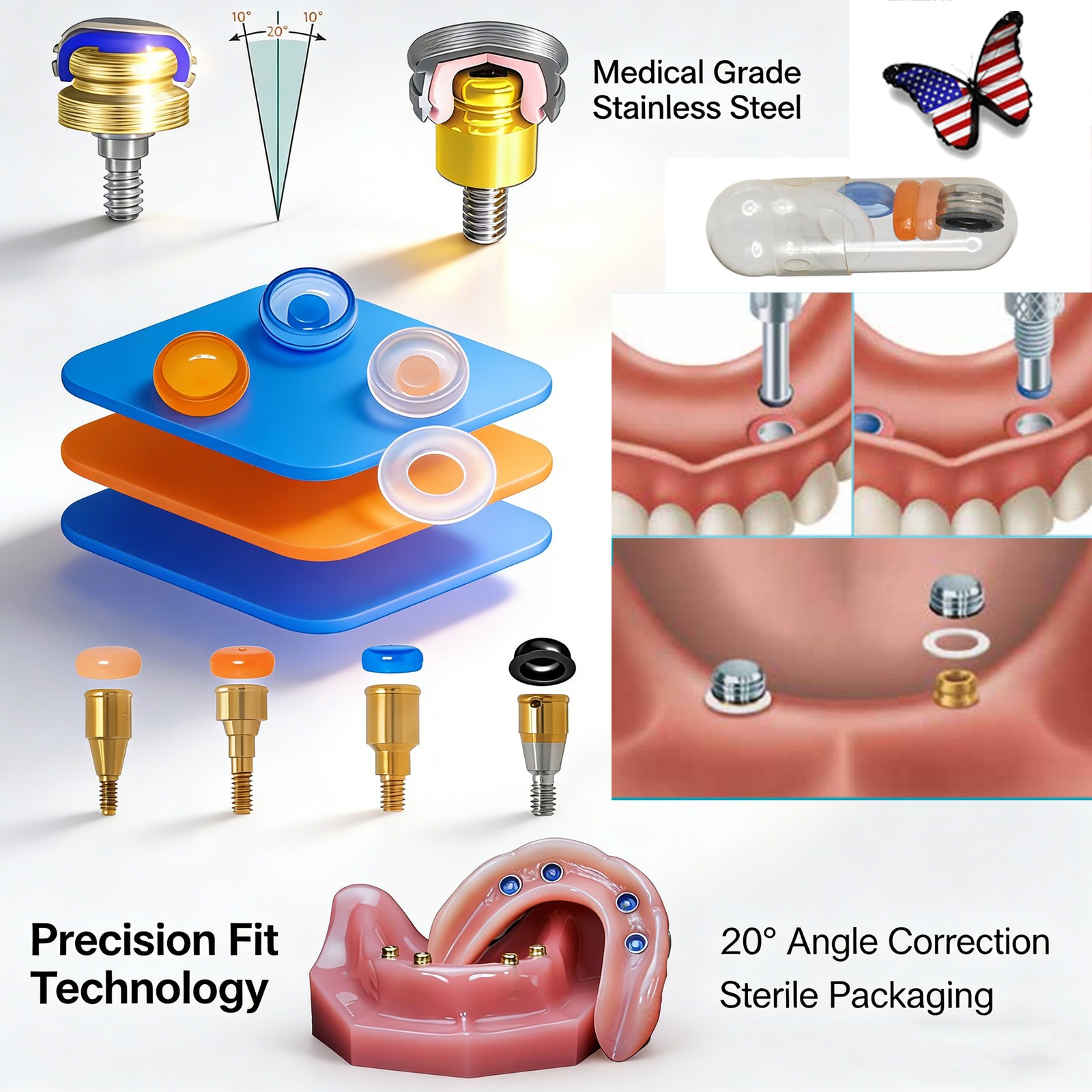Dental Overdenture Zest Locator Abutment Legacy Anchor Hiossen Nobel Zimmer Cap