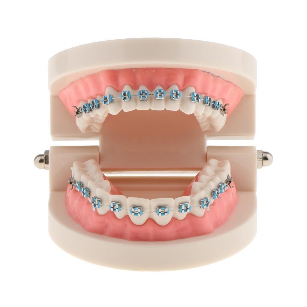 Dental Metal Model Orthodontic Adult Standard Teeth Hoop Brackets Ligature Tie