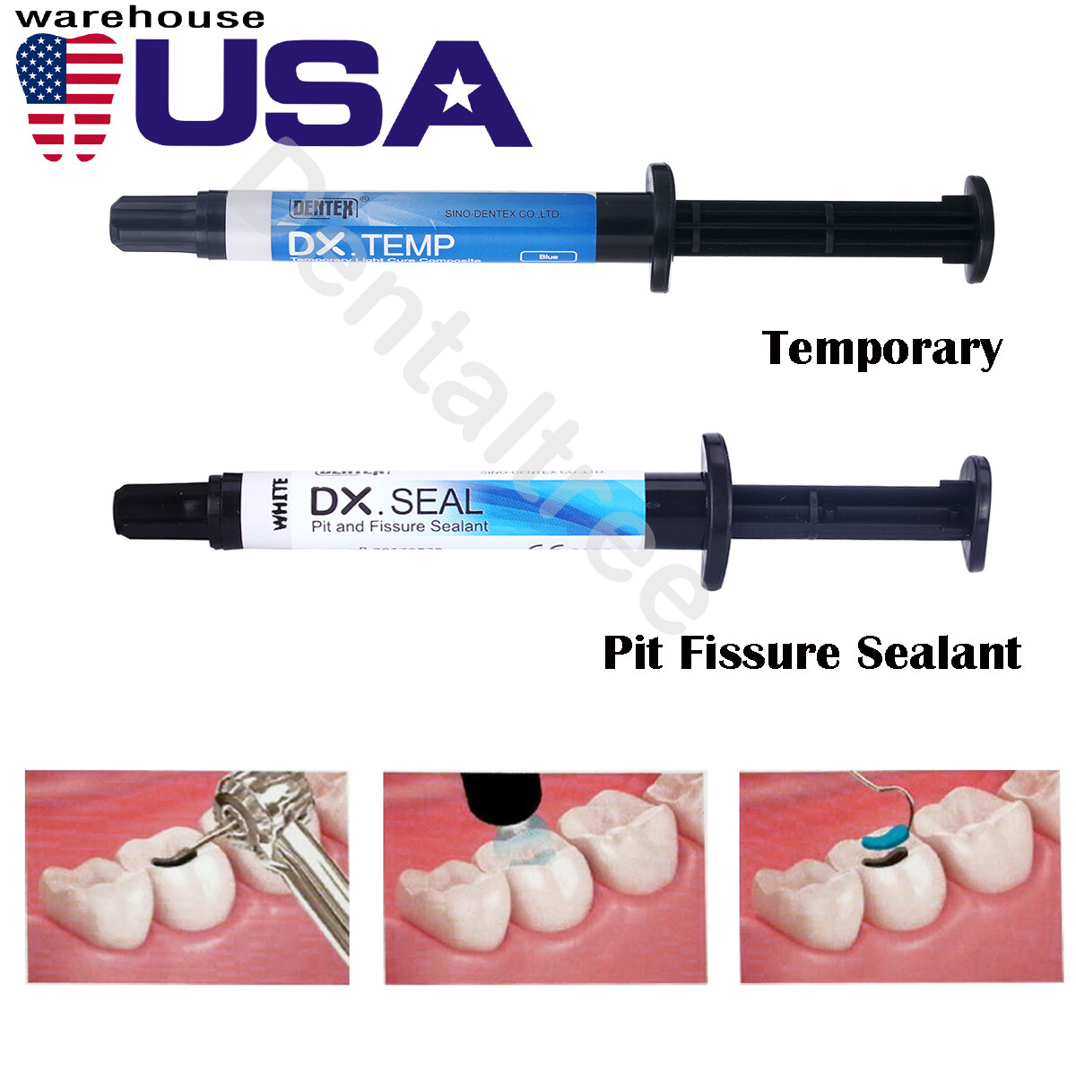 DENTEX Dental Flowable Light Cure Composite Resin Pit Fissure Sealant/Temporary