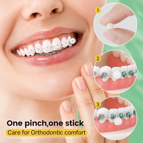 Orthodontic Braces Wax 240 Dots Individually Wrapped Mint Dental Wax