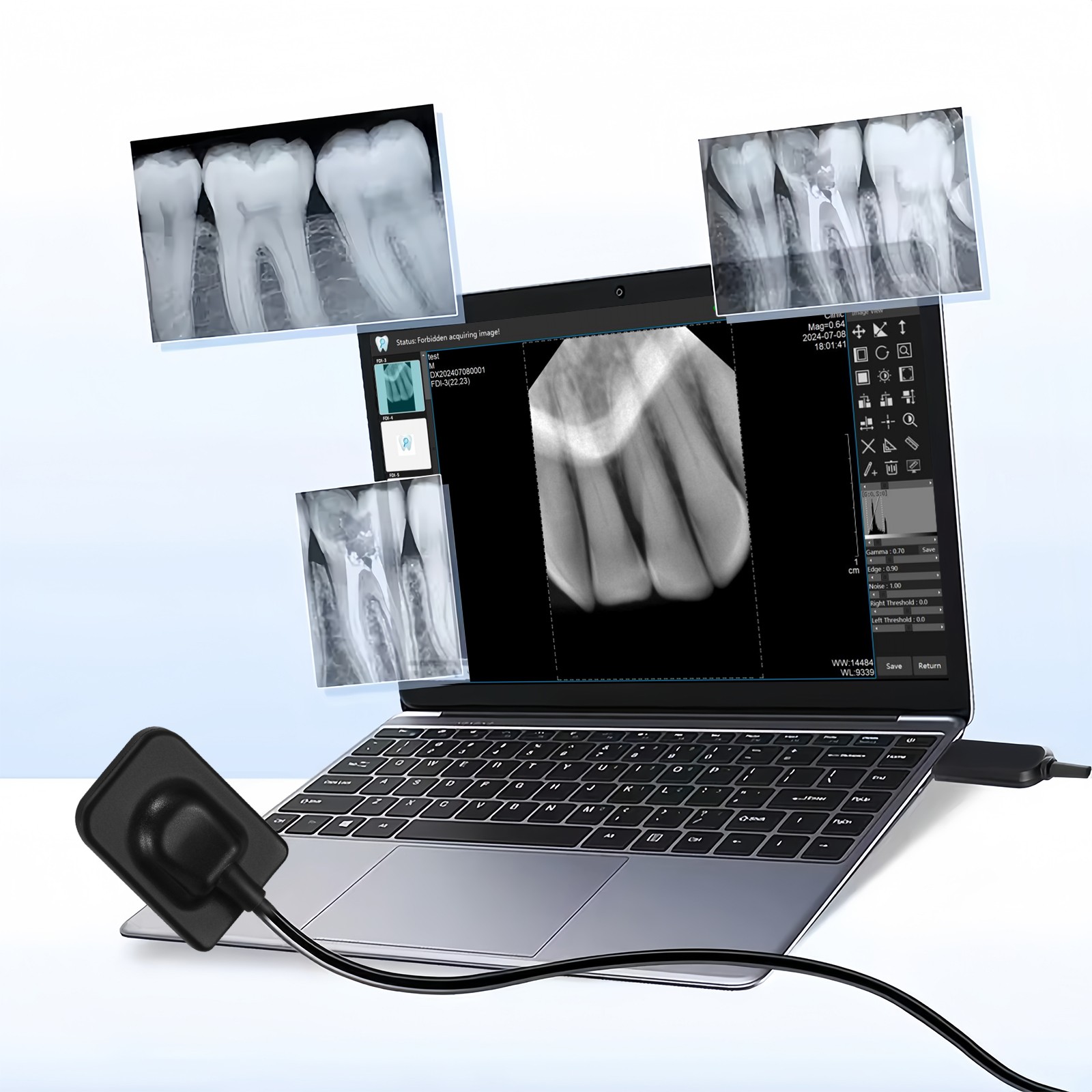 Dental X Sensor ray Digital Sensor Rayos Digital Imaging System Size 1 + Holder