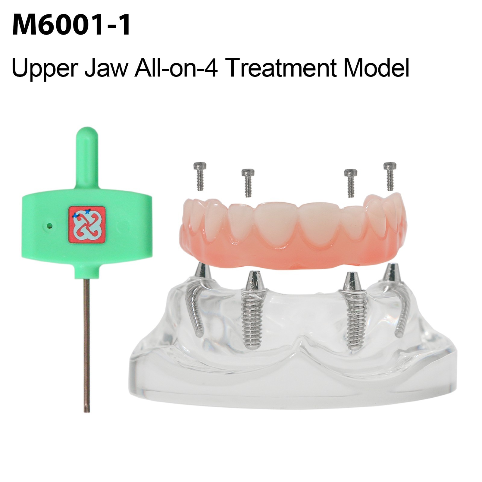 Dental Implant Overdenture Model Upper Lower Jaw Teeth Model with 2/4/6 Screws