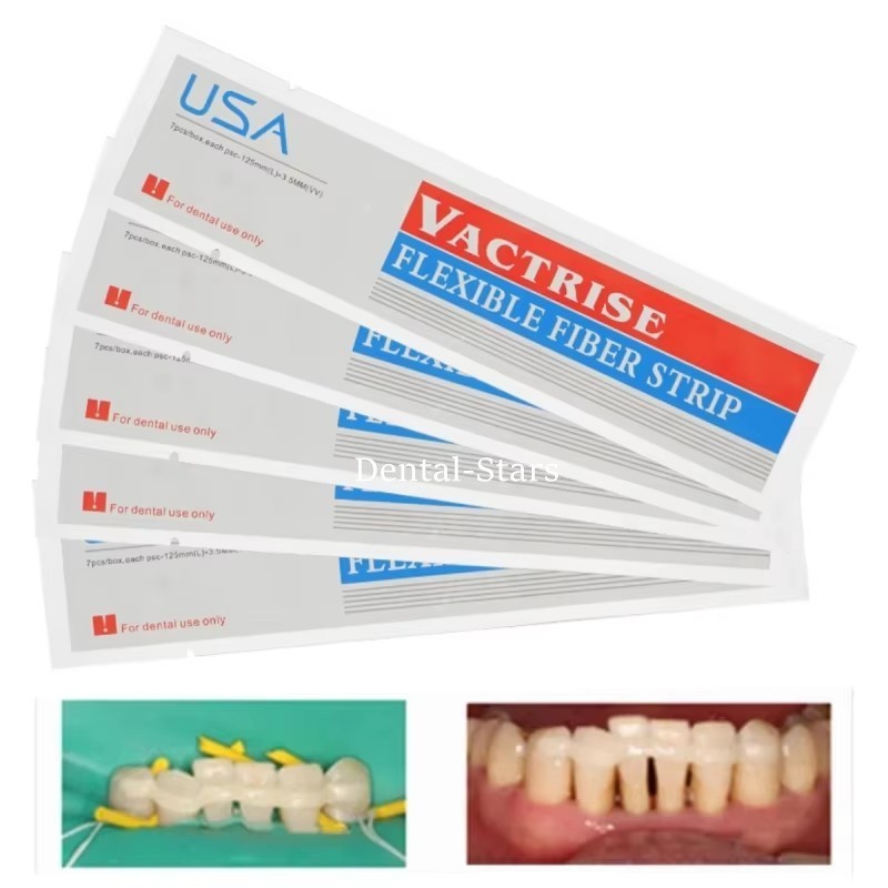 5Pcs Dental Flexible Glass Fiber Strip Splint Composite Resin Bonding Ribbon USA