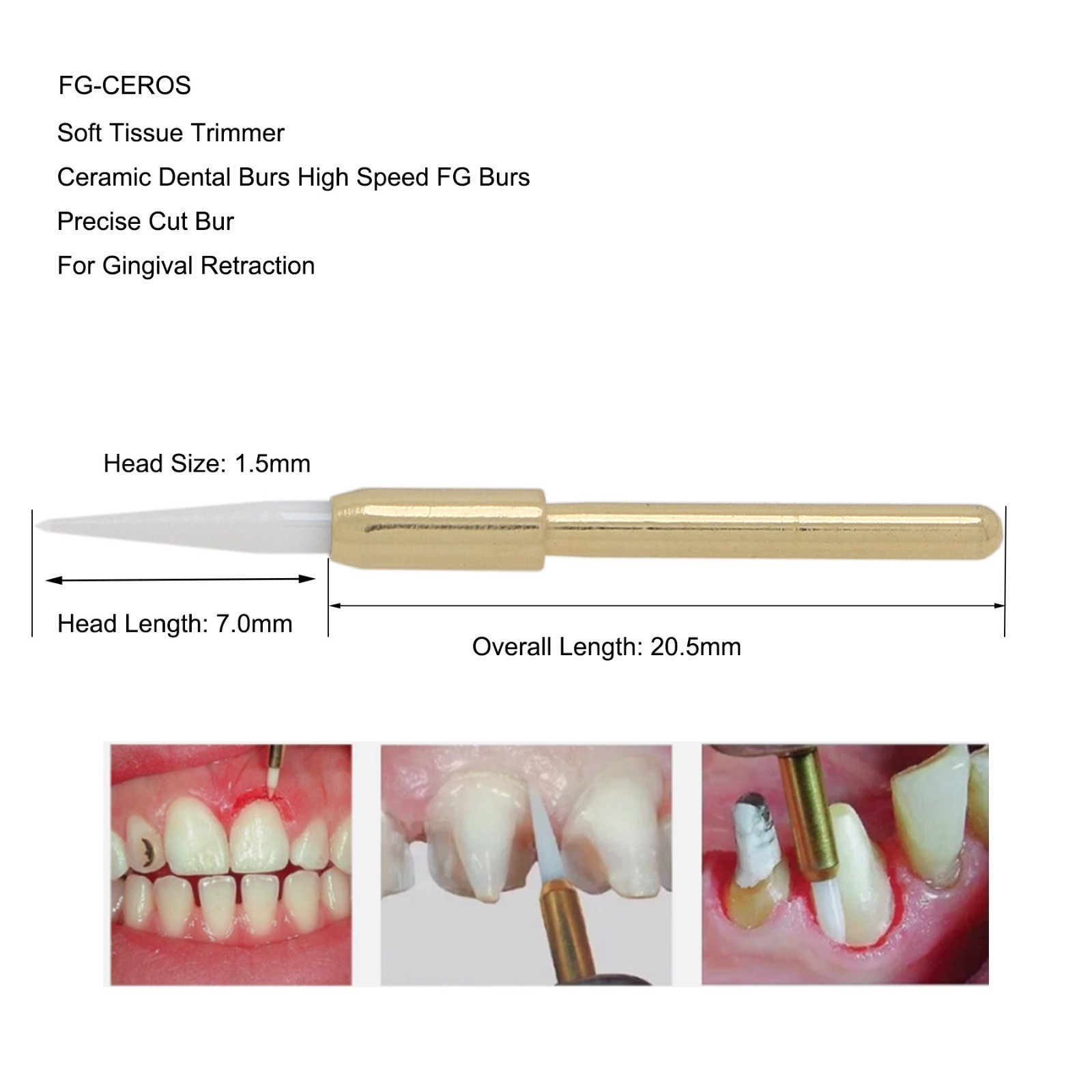 Dental Surgical Ceramic Soft Tissue Trimmer Bur for Gingivectomy