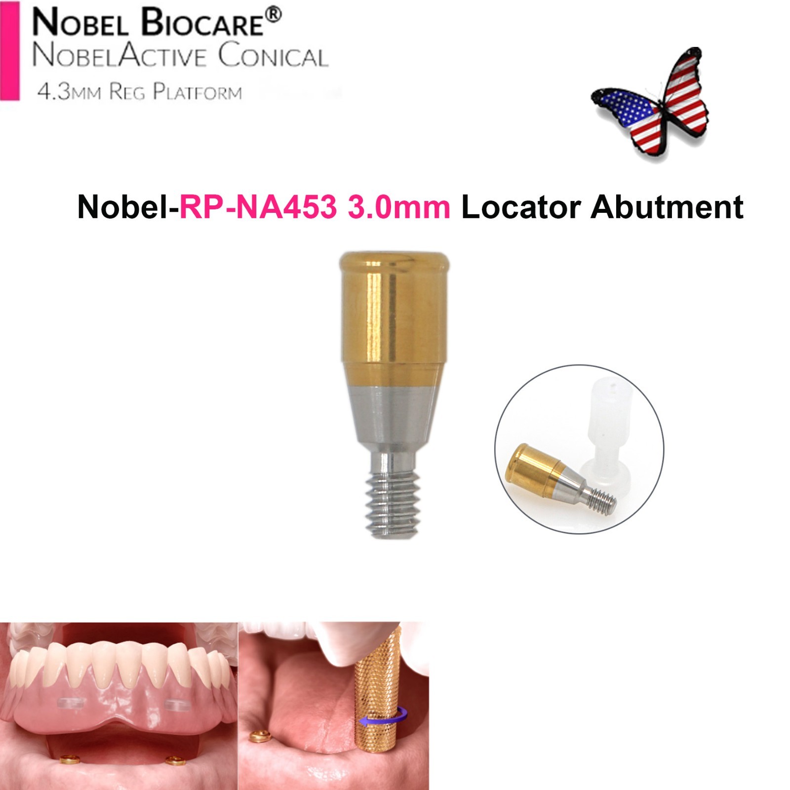 Dental Locator Abutment NP RP Compatible with Nobel NBL Active Implant AH 1–5mm