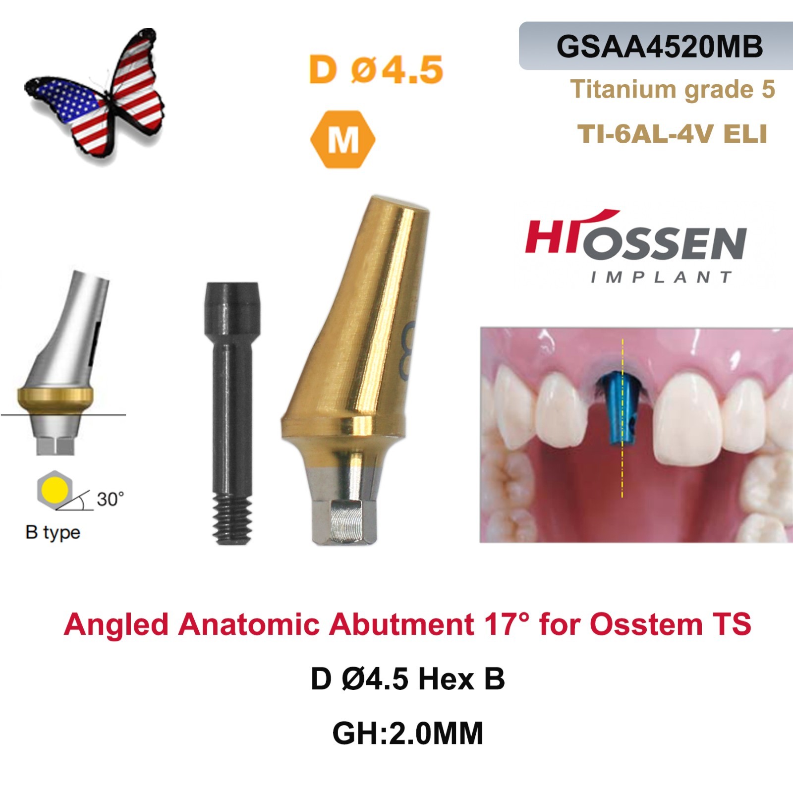US 17° Dental Angled Anatomic Abutment Hiossen/Osstem TS Mini/Regular Platform