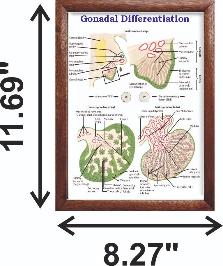 Gonadal Differentiation Chart 12×18 inches