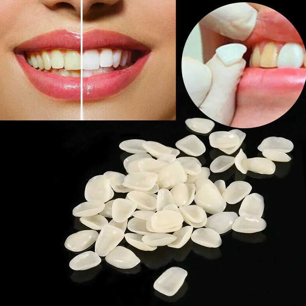 96pcs 23# A2 Dental Tooth Veneer Anterior Resin Thin Teeth Veneers Porcelain