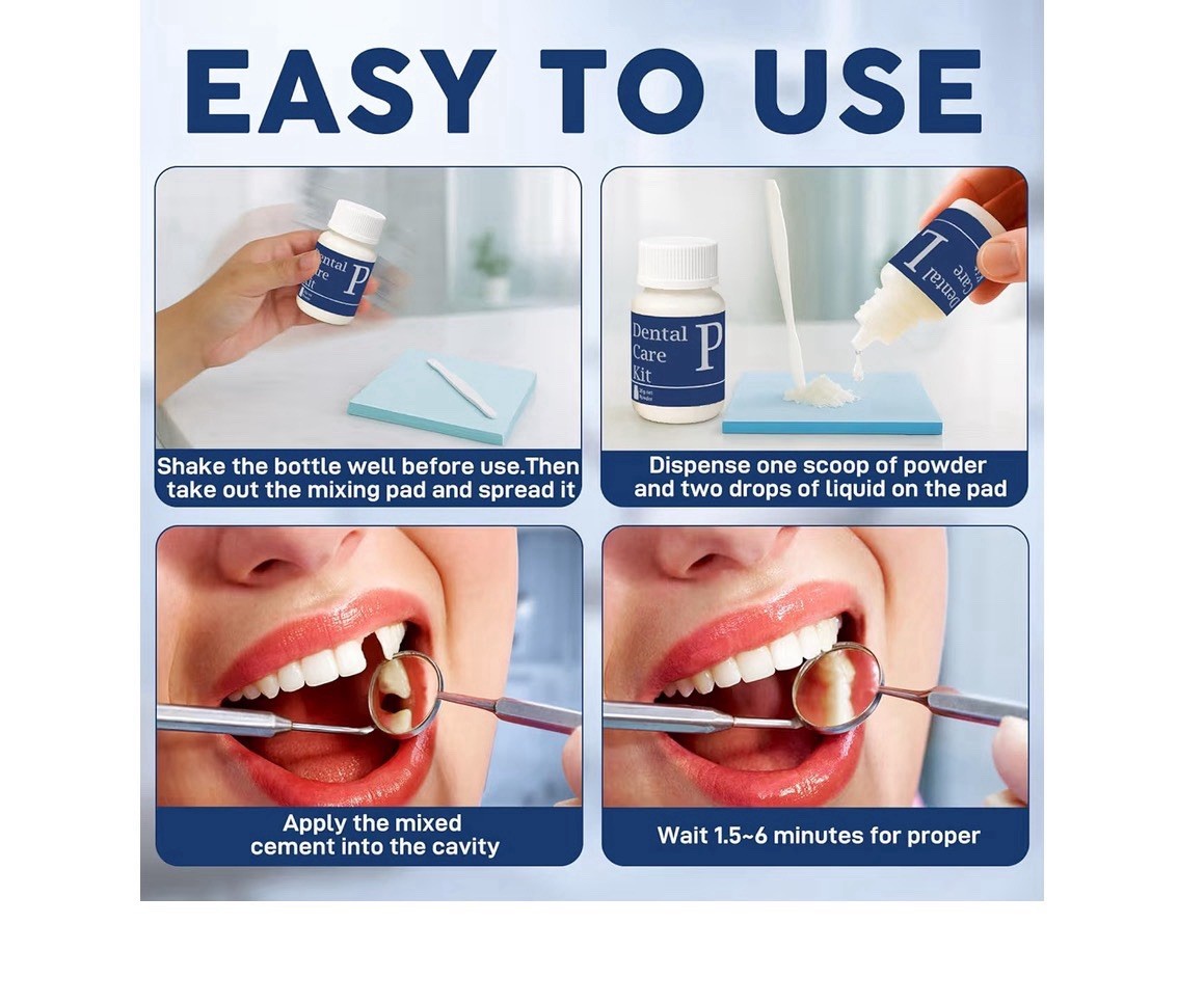 CLYVO Dental Repair Kit Zinc Oxide Eugenol Temporary Tooth Filling Crowns