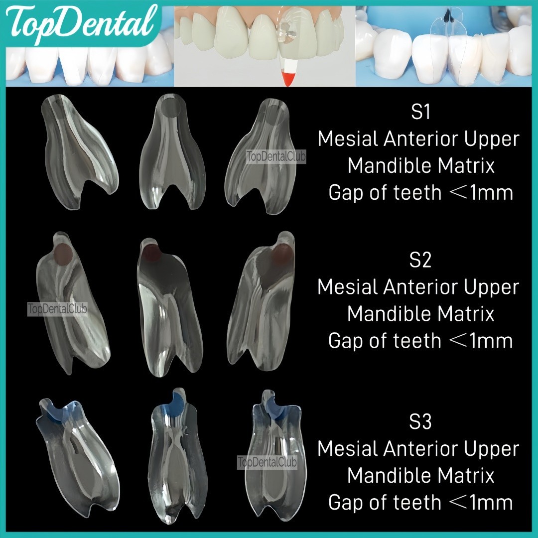 USA Clear Matrix Dental Anterior Posterior Transparent BT Matrices Fit BioClear