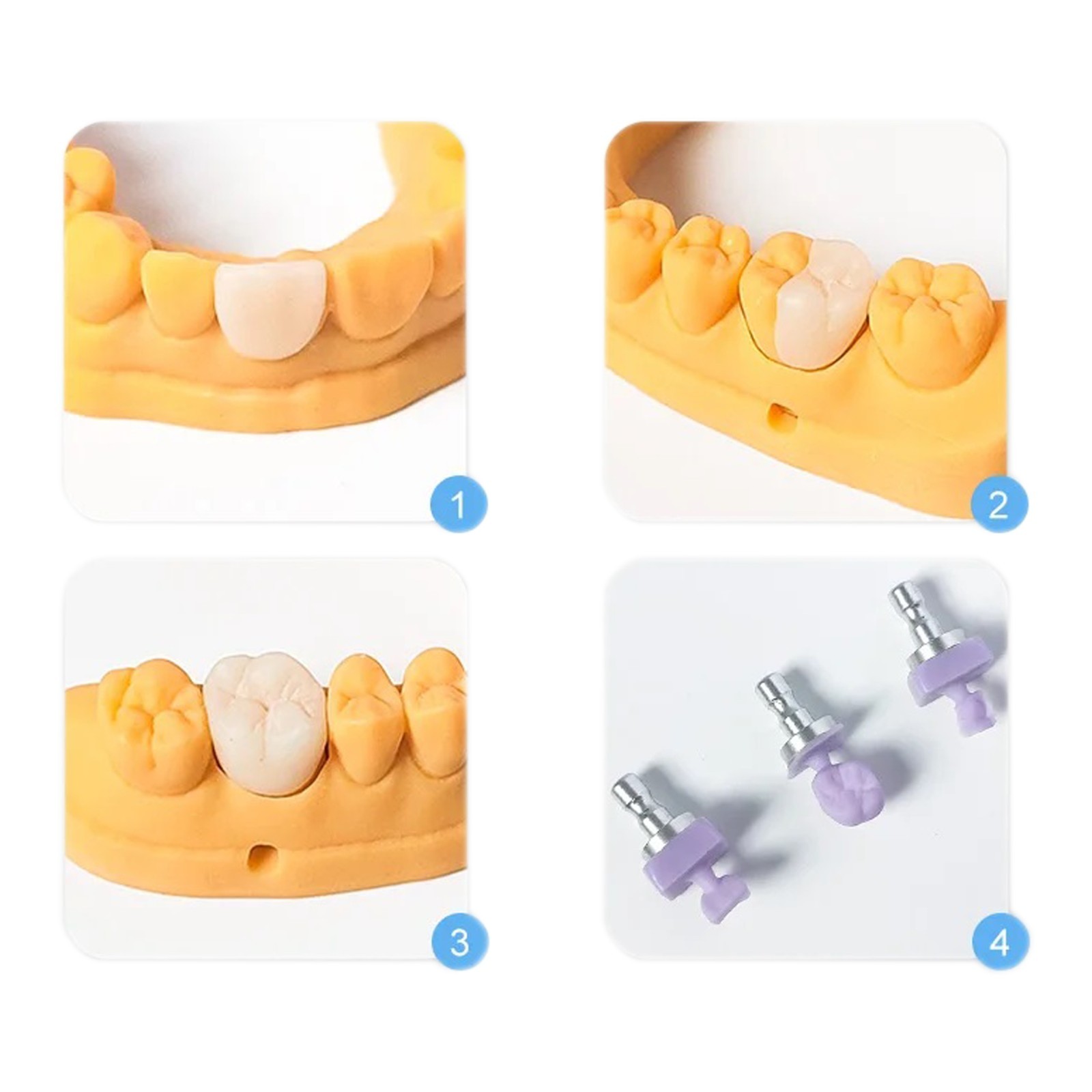 US HT C14 Emax Dental Glass Ceramic Lithium Dislicate CAD/CAM Cerec Blocks