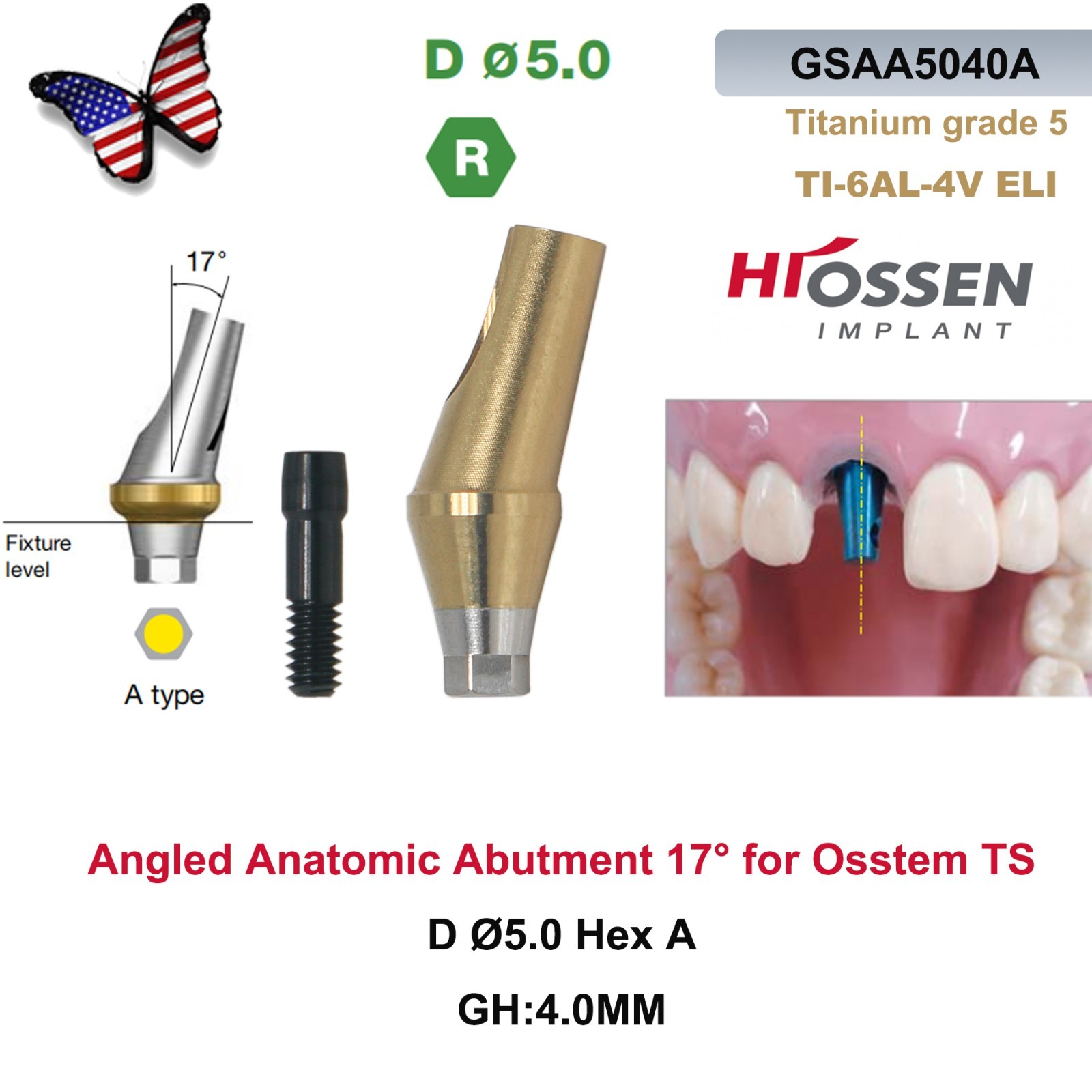 US 17° Dental Angled Anatomic Abutment Hiossen/Osstem TS Mini/Regular Platform