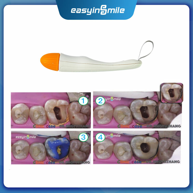 10pcs/box EASYINSMILE Dental Pro Matrix Bands Pre Formed 6MM Standard Adjustable