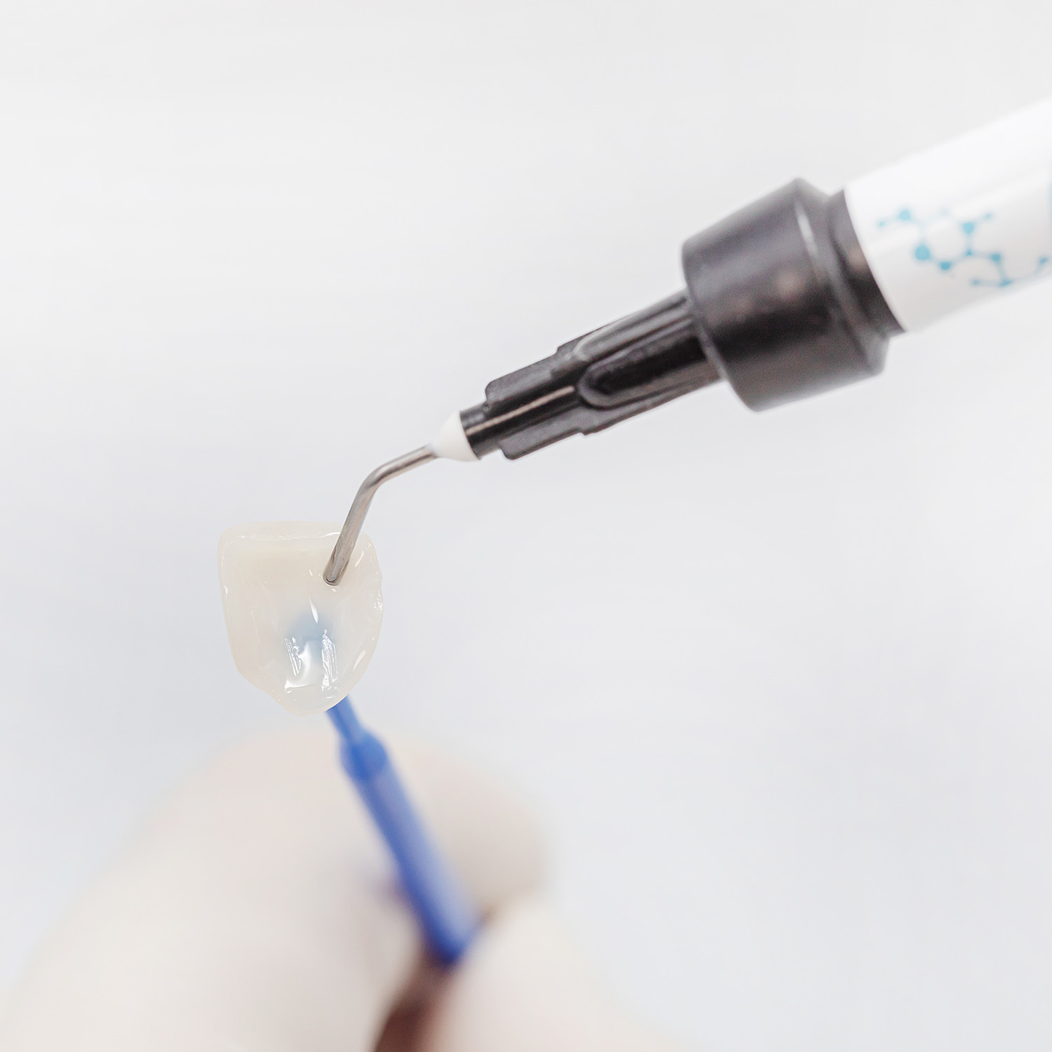 Dental Veneer Cementation Kit:2 Etching Gel/10 Veneer Cement/1 Adhesive/1 Primer