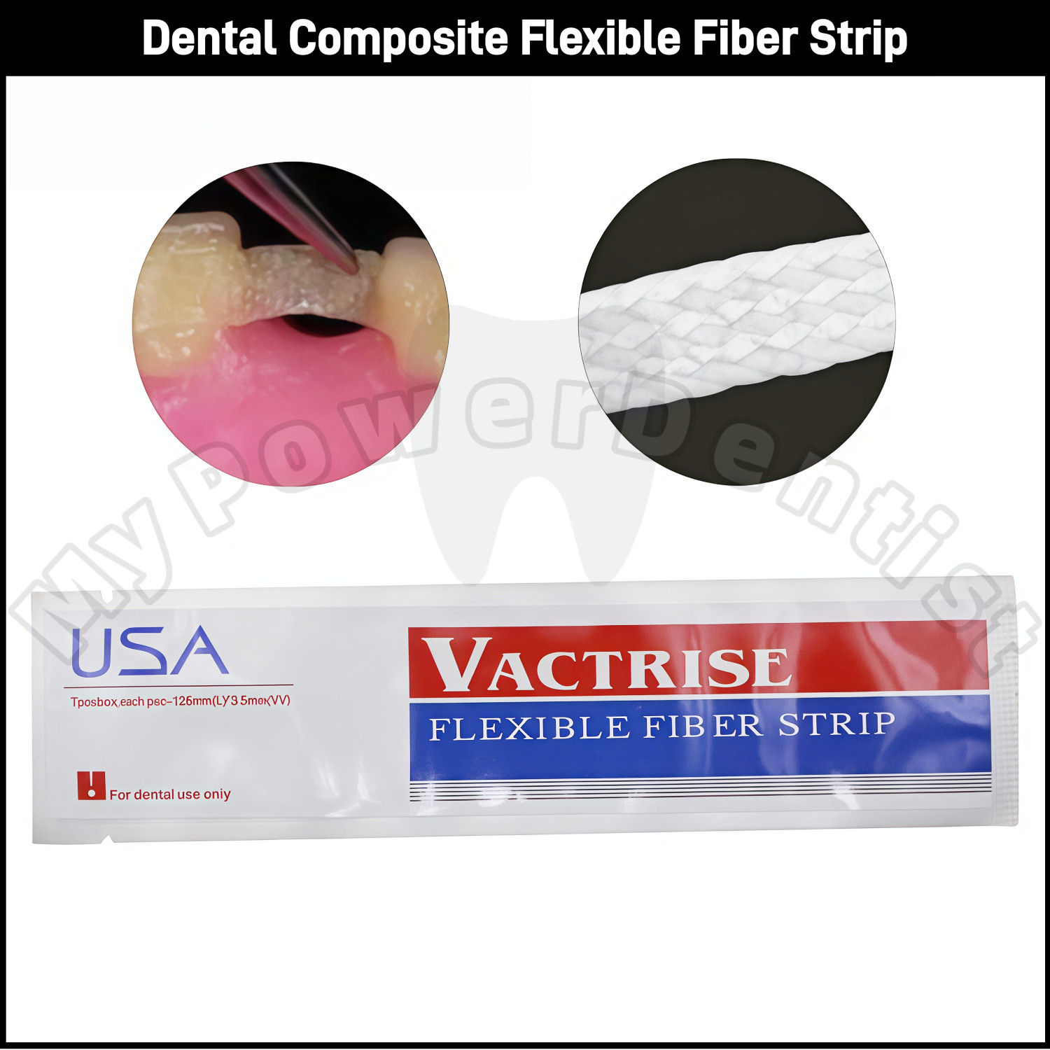 Dental Composite Flexible Fiber Strip Ribbond Ribbon Glass Fiber Bonding Strip