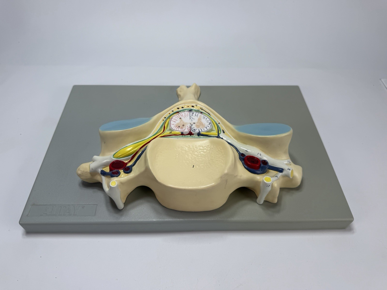 Vintage Fifth Cervical Vertebra Medical Model Heavy Plastic Numbered