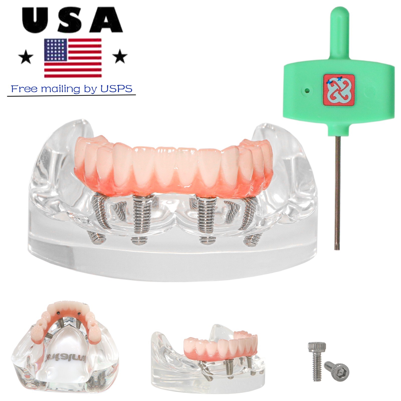 US Overdenture All-On-4/6 Implant /Ortho/Columbia 860/Kilgore NISSIN Teeth Model