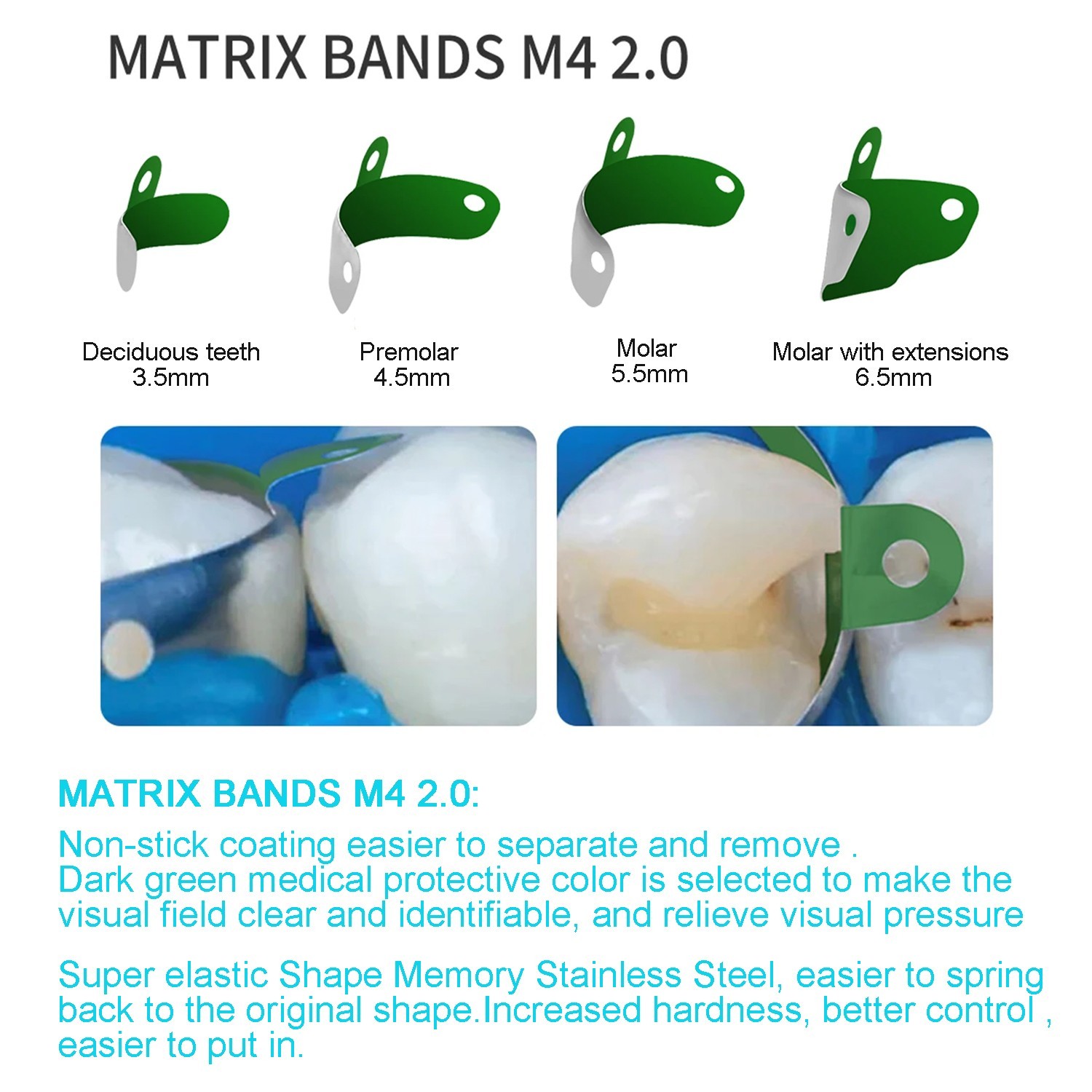 Dental Non-Stick Matrix Bands with PTFE Coated Sectional Contoured Matrices Band
