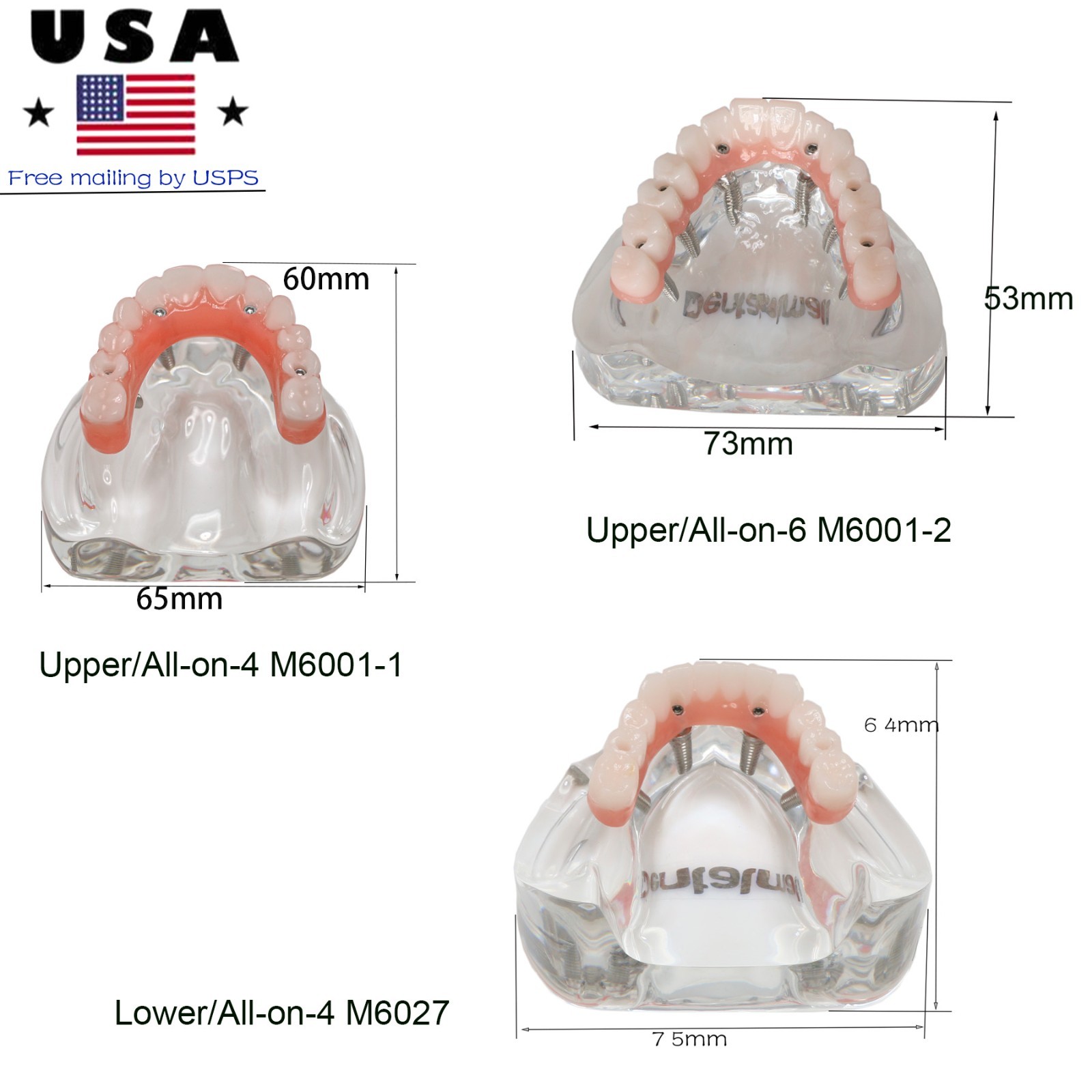 Clear Base Detachable All-on-4 /All-on-6 Overdenture Dental Implant Study Model