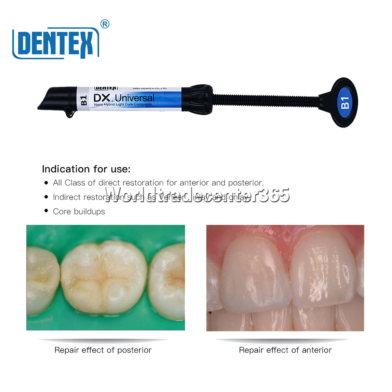 Dental Dentex Universal /Flowable Medium Flow Light Cure Composite Resin Refill