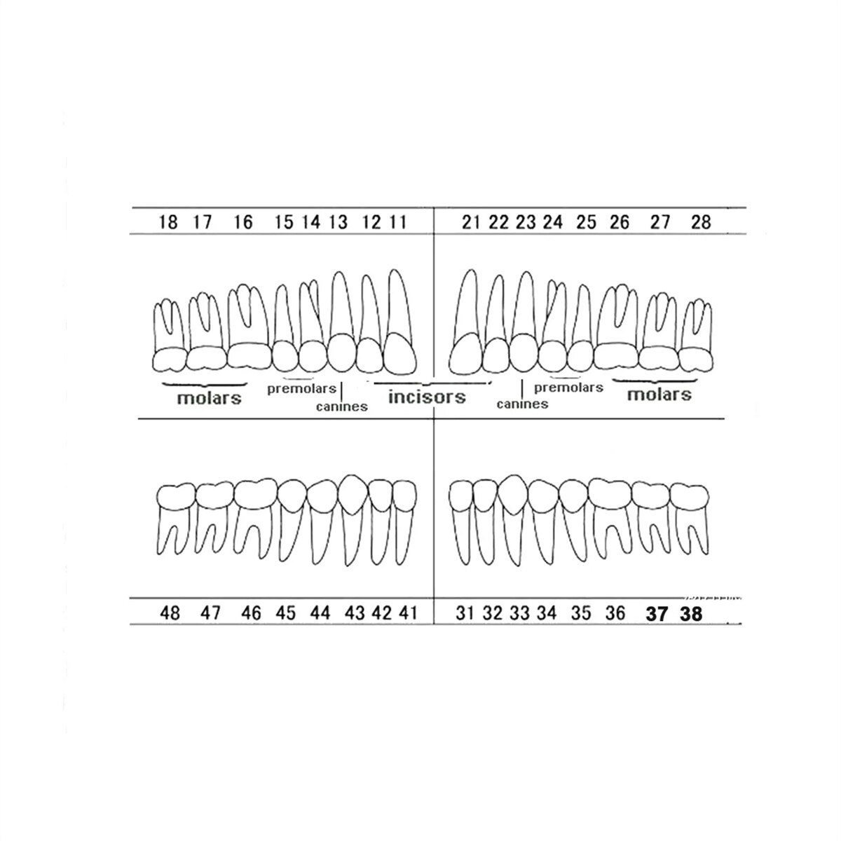 Dental Teeth Model For Kilgore NISSIN 500/200Screw-in Removable Teeth 28/32Pcs