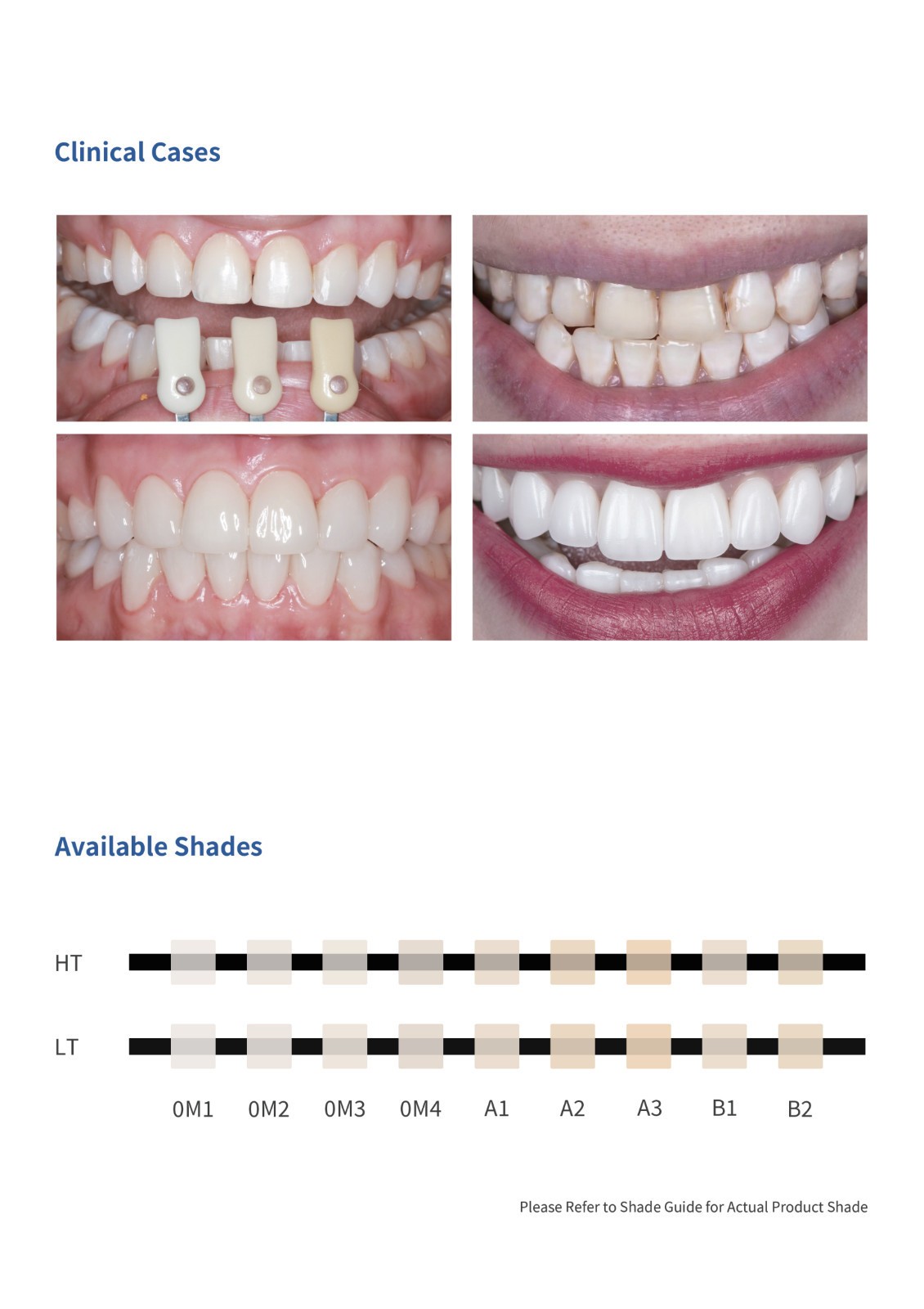 Dental Emax CAD/CAM Glass Ceramic Lithium Disilicate Blocks All Types for CEREC